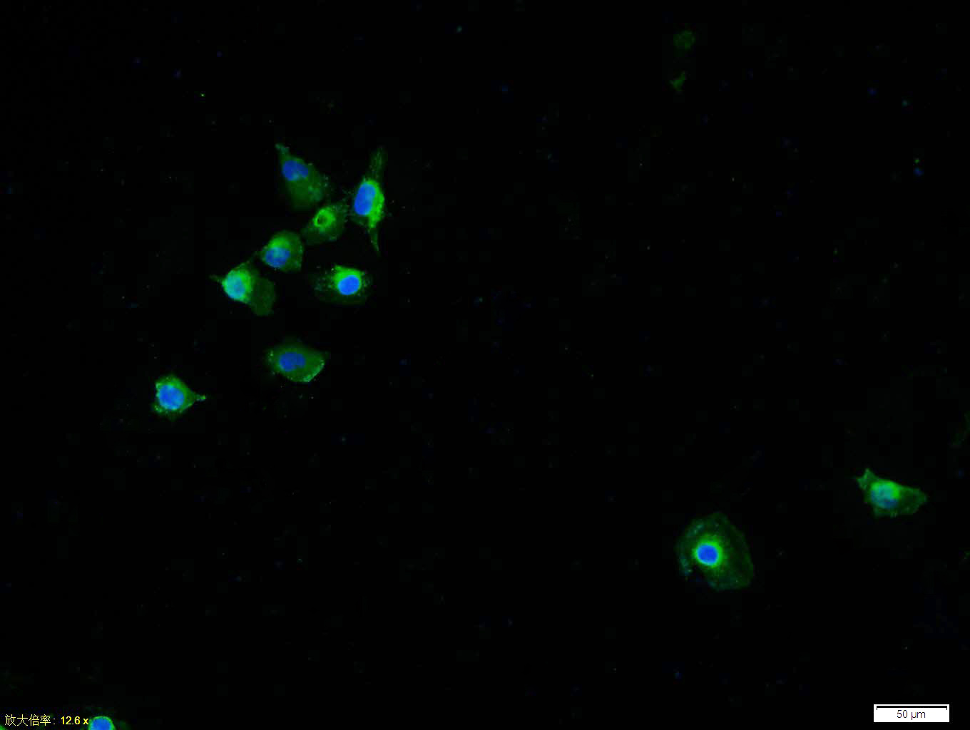 Tissue/cell: HUVEC cell; 4% Paraformaldehyde-fixed; Triton X-100 at room temperature for 20 min; Blocking buffer (normal goat serum, C-0005) at 37°C for 20 min; Antibody incubation with (P38 MAPK) polyclonal Antibody, Unconjugated (bs-0637R) 1:100, 90 minutes at 37°C; followed by a FITC conjugated Goat Anti-Rabbit IgG antibody (bs-0295G-FITC) at 37°C for 90 minutes, DAPI (blue, C02-04002) was used to stain the cell nuclei.