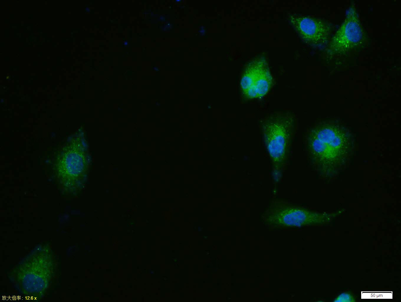 Tissue/cell: HUVEC cell; 4% Paraformaldehyde-fixed; Triton X-100 at room temperature for 20 min; Blocking buffer (normal goat serum, C-0005) at 37°C for 20 min; Antibody incubation with (ERK1 + ERK2) Polyclonal Antibody, Unconjugated (bs-2637R) 1:100, 90 minutes at 37°C; followed by a conjugated Goat Anti-Rabbit IgG antibody (bs-0295G-FITC) at 37°C for 90 minutes, DAPI (blue, C02-04002) was used to stain the cell nuclei.