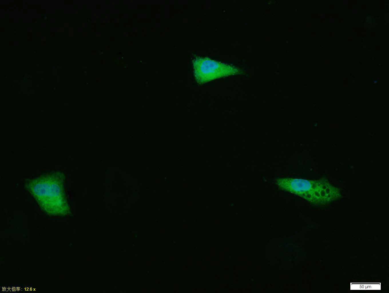 Tissue/cell: HUVEC cell; 4% Paraformaldehyde-fixed; Triton X-100 at room temperature for 20 min; Blocking buffer (normal goat serum, C-0005) at 37°C for 20 min; Antibody incubation with (ERK1 + ERK2) Polyclonal Antibody, Unconjugated (bs-2637R) 1:100, 90 minutes at 37°C; followed by a conjugated Goat Anti-Rabbit IgG antibody (bs-0295G-FITC) at 37°C for 90 minutes, DAPI (blue, C02-04002) was used to stain the cell nuclei.