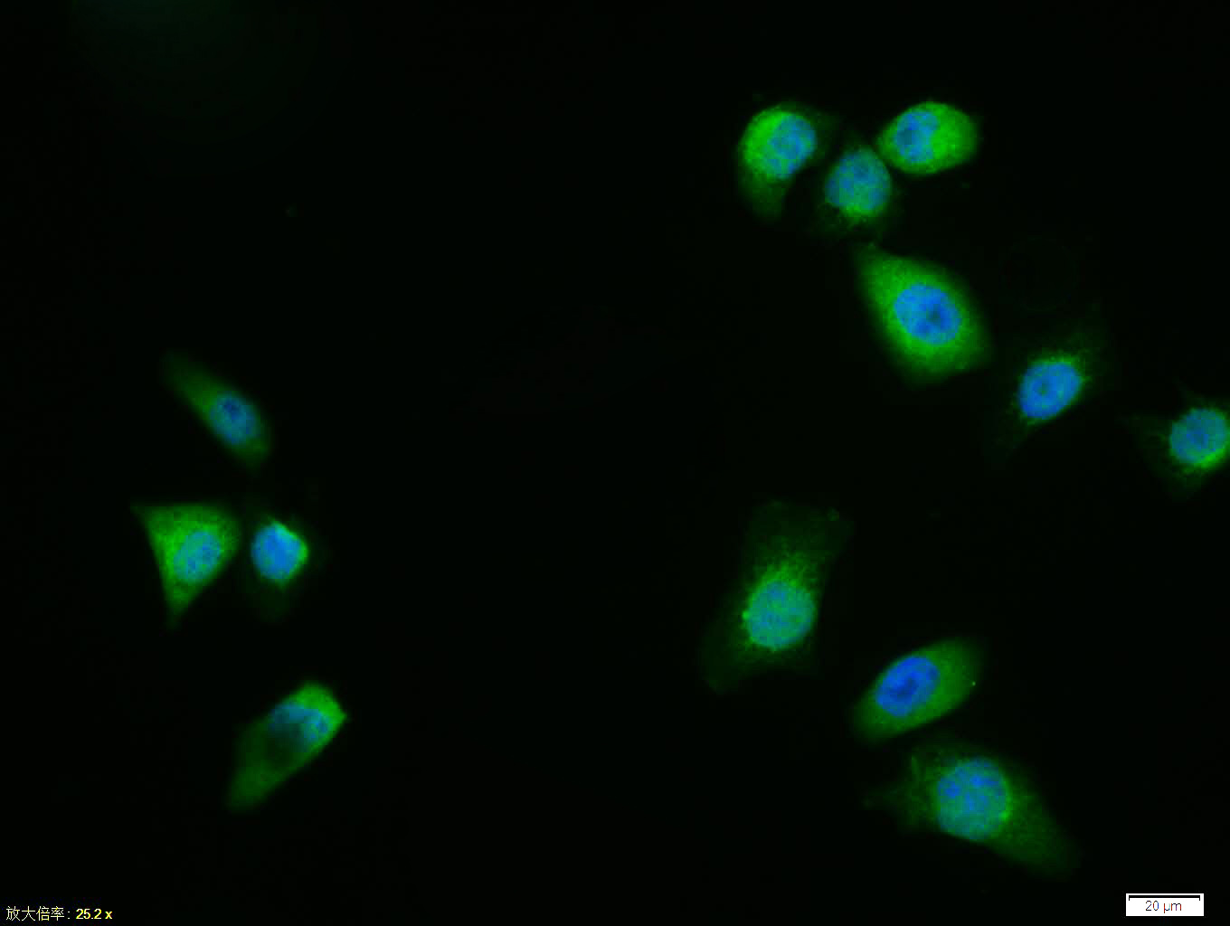 Tissue/cell:Hela cell; 4% Paraformaldehyde-fixed; Triton X-100 at room temperature for 20 min; Blocking buffer (normal goat serum, C-0005) at 37°C for 20 min; Antibody incubation with (MTOR) polyclonal Antibody, Unconjugated (bs-1992R) 1:100, 90 minutes at 37°C; followed by a FITC conjugated Goat Anti-Rabbit IgG antibody at 37°C for 90 minutes, DAPI (blue, C02-04002) was used to stain the cell nuclei.