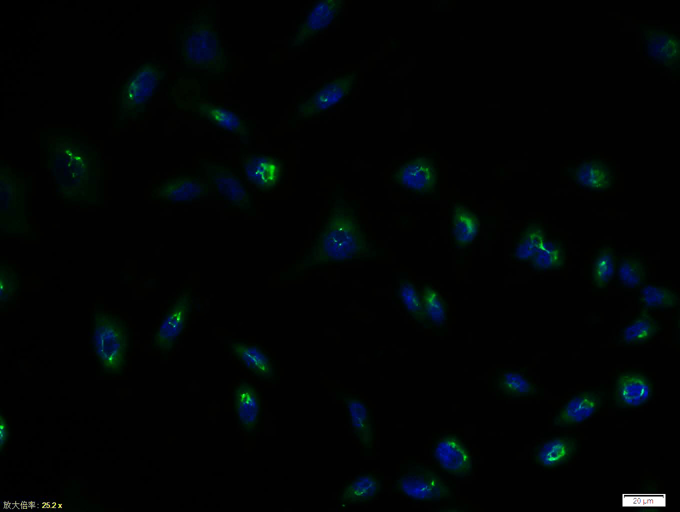 Tissue/cell: NIH/3T3 cell; 4% Paraformaldehyde-fixed; Triton X-100 at room temperature for 20 min; Blocking buffer (normal goat serum, C-0005) at 37°C for 20 min; Antibody incubation with (GLUT4) polyclonal Antibody, Unconjugated (bs-0384R) 1:100, 90 minutes at 37°C; followed by a FITC conjugated Goat Anti-Rabbit IgG antibody at 37°C for 90 minutes, DAPI (blue, C02-04002) was used to stain the cell nuclei.