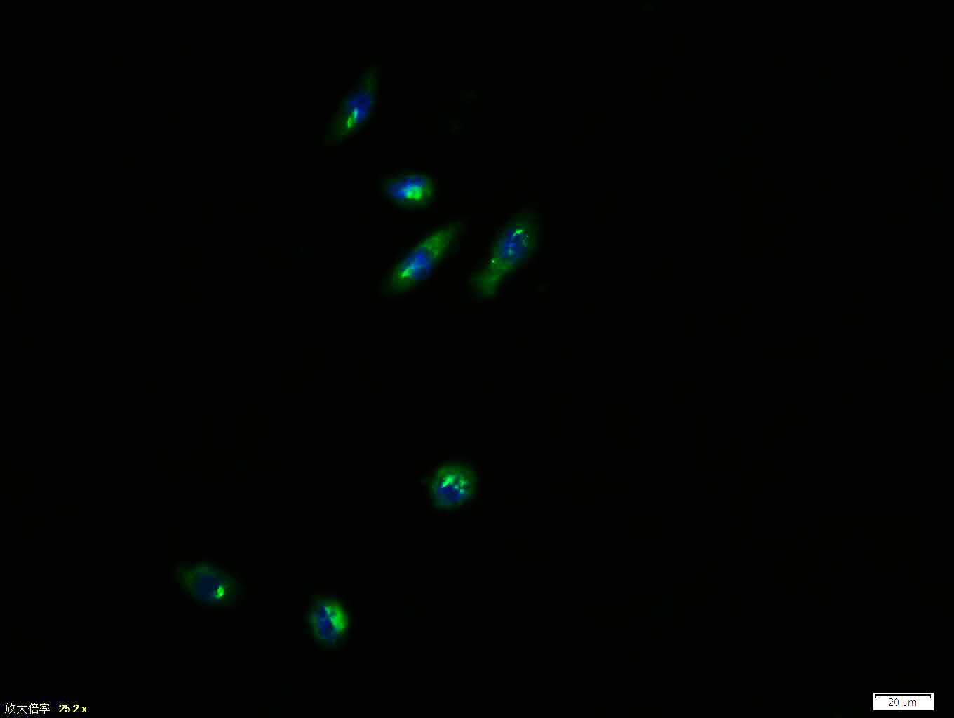 Tissue/cell: NIH/3T3 cell; 4% Paraformaldehyde-fixed; Triton X-100 at room temperature for 20 min; Blocking buffer (normal goat serum, C-0005) at 37°C for 20 min; Antibody incubation with (PI 3 Kinase p85 alpha) polyclonal Antibody, Unconjugated (bs-0128R) 1:100, 90 minutes at 37°C; followed by a FITC conjugated Goat Anti-Rabbit IgG antibody at 37°C for 90 minutes, DAPI (blue, C02-04002) was used to stain the cell nuclei.