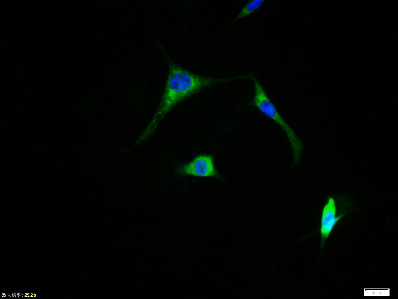 Tissue/cell: A431 cell; 4% Paraformaldehyde-fixed; Triton X-100 at room temperature for 20 min; Blocking buffer (normal goat serum, C-0005) at 37°C for 20 min; Antibody incubation with (c-fos) polyclonal Antibody, Unconjugated (bs-0469R) 1:100, 90 minutes at 37°C; followed by a FITC conjugated Goat Anti-Rabbit IgG antibody at 37°C for 90 minutes, DAPI (blue, C02-04002) was used to stain the cell nuclei.