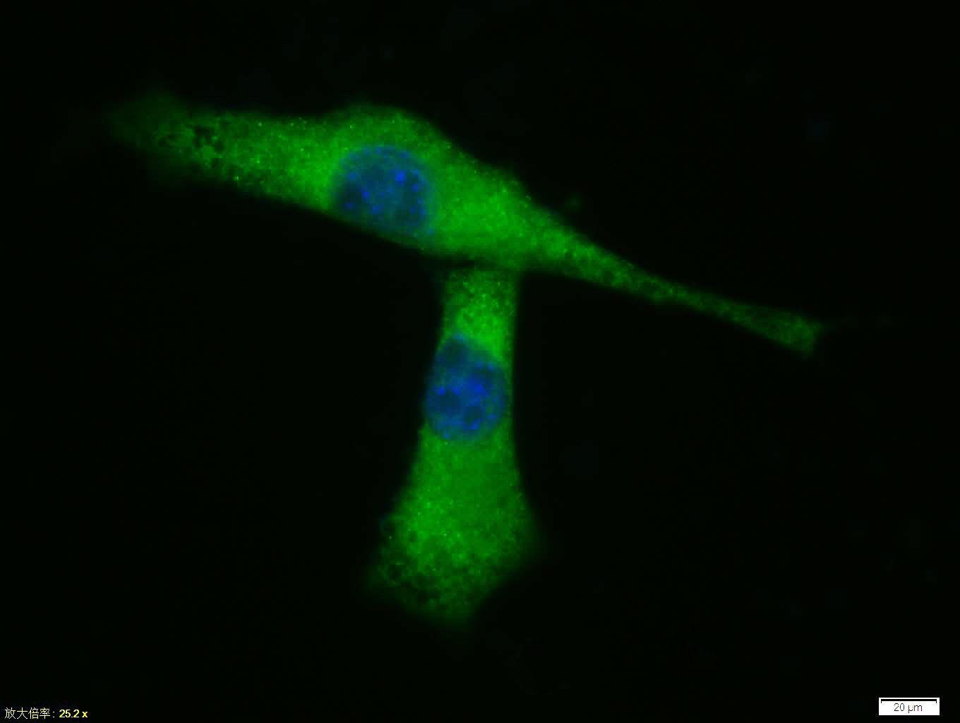 Tissue/cell: A431 cell; 4% Paraformaldehyde-fixed; Triton X-100 at room temperature for 20 min; Blocking buffer (normal goat serum, C-0005) at 37°C for 20 min; Antibody incubation with (E cadherin) polyclonal Antibody, Unconjugated (bs-1519R) 1:100, 90 minutes at 37°C; followed by a FITC conjugated Goat Anti-Rabbit IgG antibody at 37°C for 90 minutes, DAPI (blue, C02-04002) was used to stain the cell nuclei.