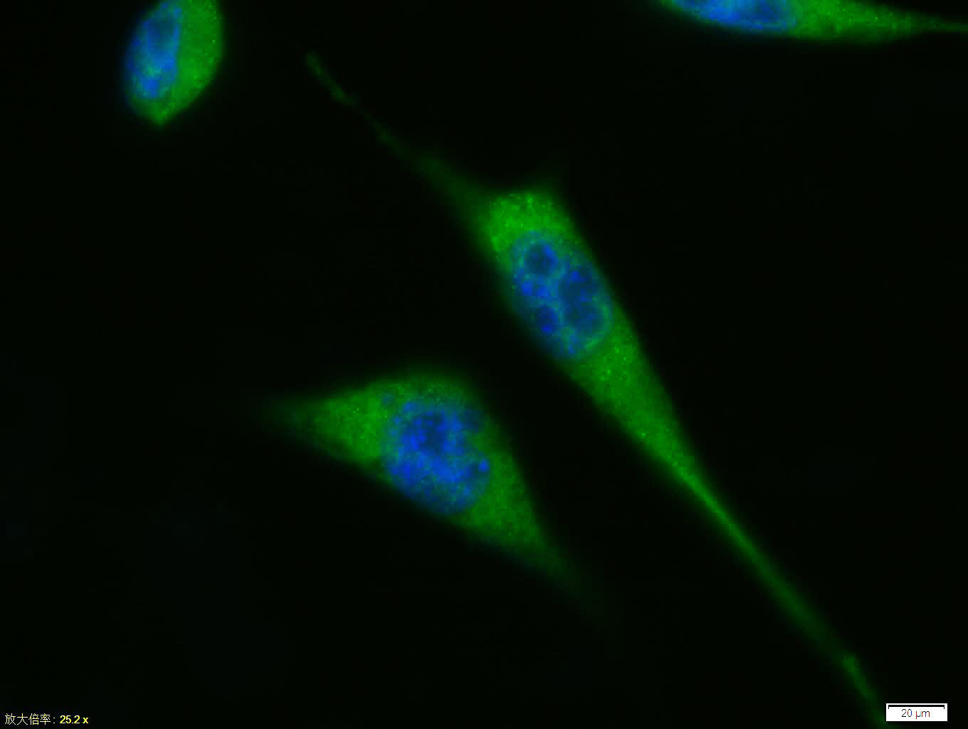 Tissue/cell: A431 cell; 4% Paraformaldehyde-fixed; Triton X-100 at room temperature for 20 min; Blocking buffer (normal goat serum, C-0005) at 37°C for 20 min; Antibody incubation with (P53 protein(wt-p53)) polyclonal Antibody, Unconjugated (bs-0033R) 1:100, 90 minutes at 37°C; followed by a FITC conjugated Goat Anti-Rabbit IgG antibody at 37°C for 90 minutes, DAPI (blue, C02-04002) was used to stain the cell nuclei.