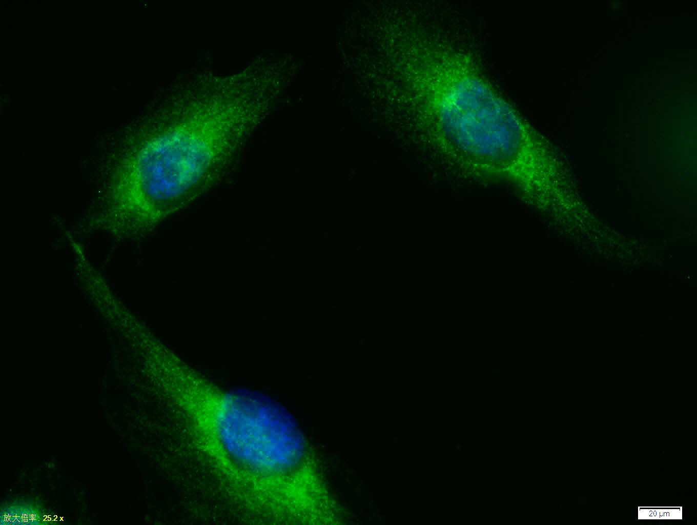 Tissue/cell: A549 cell; 4% Paraformaldehyde-fixed; Triton X-100 at room temperature for 20 min; Blocking buffer (normal goat serum, C-0005) at 37°C for 20 min; Antibody incubation with (phospho-AKT1+AKT2+AKT3 (Tyr315+316+312) ) polyclonal Antibody, Unconjugated (bs-5193R) 1:100, 90 minutes at 37°C; followed by a FITC conjugated Goat Anti-Rabbit IgG antibody at 37°C for 90 minutes, DAPI (blue, C02-04002) was used to stain the cell nuclei.