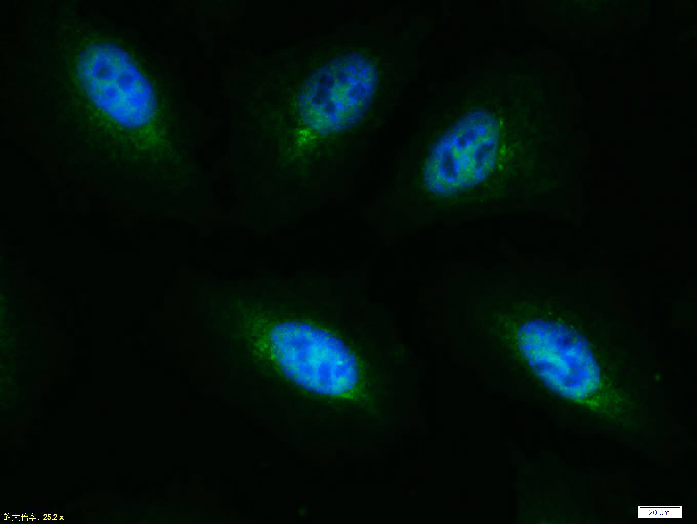 Tissue/cell: A549 cell; 4% Paraformaldehyde-fixed; Triton X-100 at room temperature for 20 min; Blocking buffer (normal goat serum, C-0005) at 37°C for 20 min; Antibody incubation with (phospho-AKT1 + AKT2 + AKT3 (Thr308+Thr309+Thr305)) polyclonal Antibody, Unconjugated (bs-5182R) 1:100, 90 minutes at 37°C; followed by a FITC conjugated Goat Anti-Rabbit IgG antibody at 37°C for 90 minutes, DAPI (blue, C02-04002) was used to stain the cell nuclei.