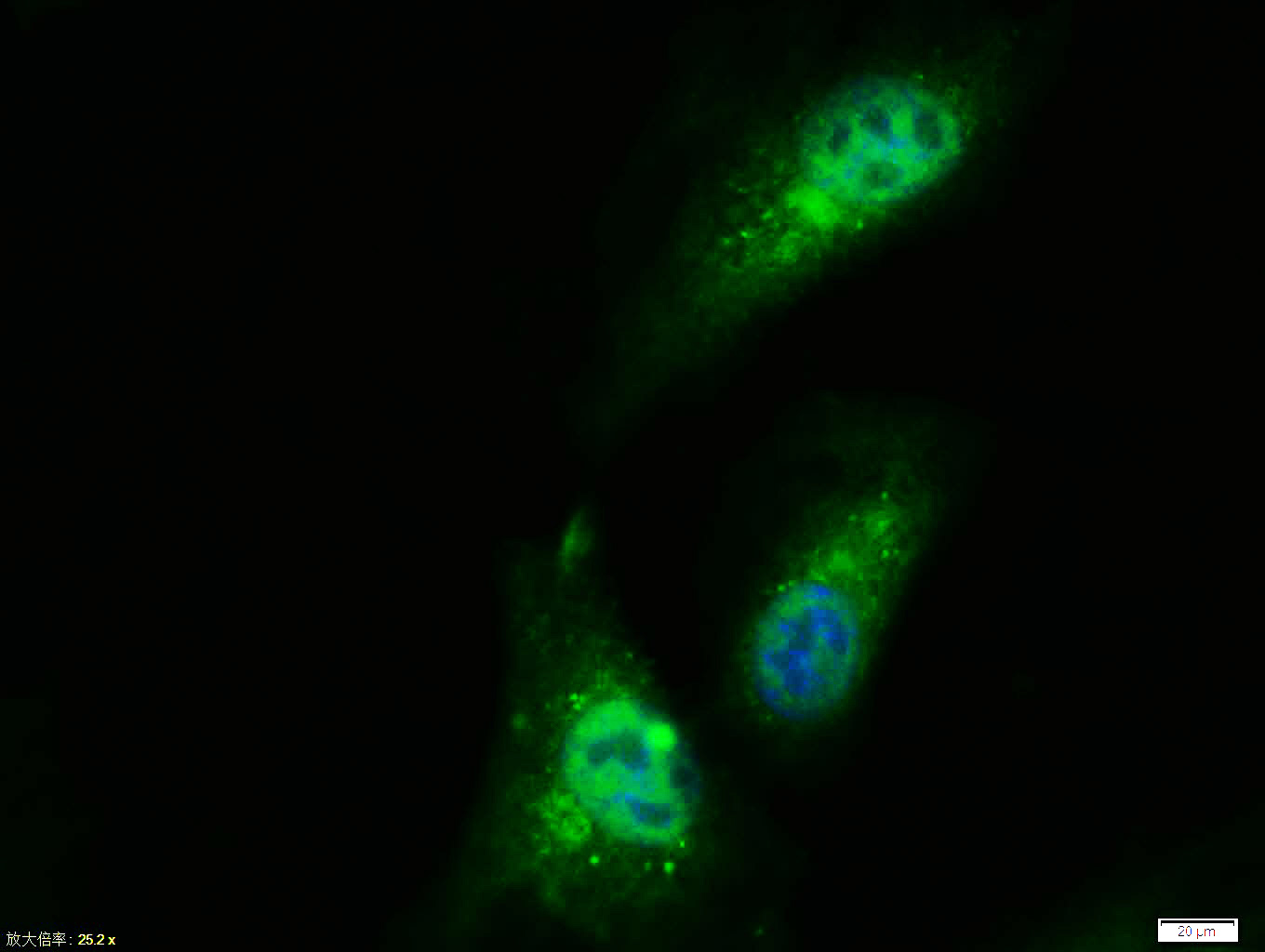 Tissue/cell: A549 cell; 4% Paraformaldehyde-fixed; Triton X-100 at room temperature for 20 min; Blocking buffer (normal goat serum, C-0005) at 37°C for 20 min; Antibody incubation with (PPAR gamma) polyclonal Antibody, Unconjugated (bs-0530R) 1:100, 90 minutes at 37°C; followed by a FITC conjugated Goat Anti-Rabbit IgG antibody at 37°C for 90 minutes, DAPI (blue, C02-04002) was used to stain the cell nuclei.