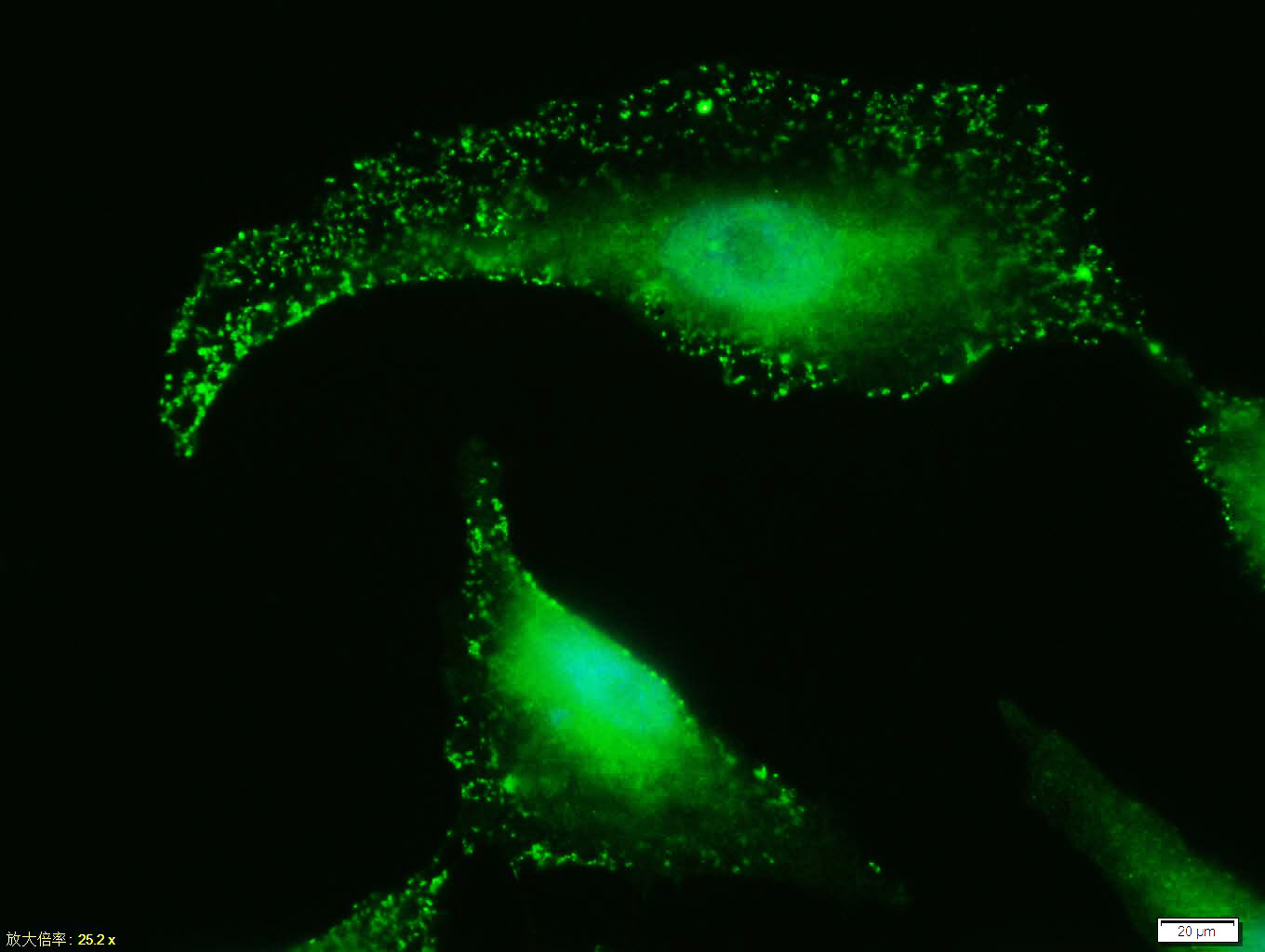 Tissue/cell: A549 cell; 4% Paraformaldehyde-fixed; Triton X-100 at room temperature for 20 min; Blocking buffer (normal goat serum, C-0005) at 37°C for 20 min; Antibody incubation with (STAT3) polyclonal Antibody, Unconjugated (bs-1141R) 1:100, 90 minutes at 37°C; followed by a FITC conjugated Goat Anti-Rabbit IgG antibody at 37°C for 90 minutes, DAPI (blue, C02-04002) was used to stain the cell nuclei.