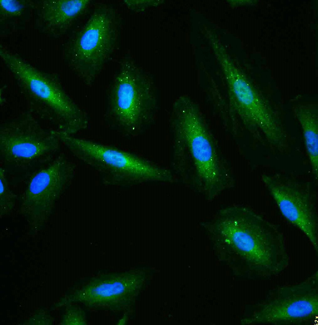 Tissue/cell: A549 cell; 4% Paraformaldehyde-fixed; Triton X-100 at room temperature for 20 min; Blocking buffer (normal goat serum, C-0005) at 37°C for 20 min; Antibody incubation with (GAPDH (Loading Control)) polyclonal Antibody, Unconjugated (bs-10900R) 1:100, 90 minutes at 37°C; followed by a FITC conjugated Goat Anti-Rabbit IgG antibody at 37°C for 90 minutes, DAPI (blue, C02-04002) was used to stain the cell nuclei.