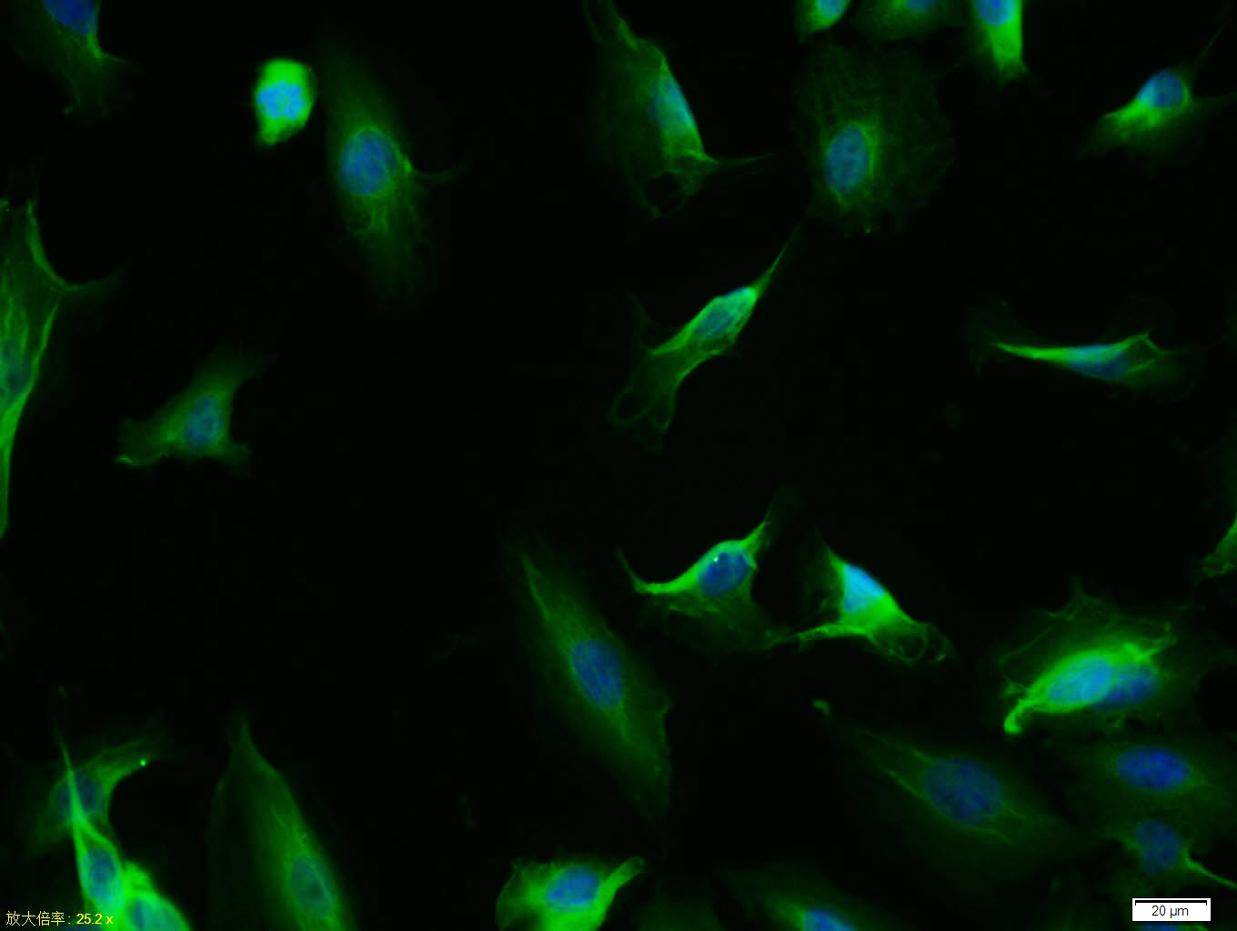 Tissue/cell: A549 cell; 4% Paraformaldehyde-fixed; Triton X-100 at room temperature for 20 min; Blocking buffer (normal goat serum, C-0005) at 37°C for 20 min; Antibody incubation with (P53 protein(wt-p53)) polyclonal Antibody, Unconjugated (bs-0033R) 1:100, 90 minutes at 37°C; followed by a FITC conjugated Goat Anti-Rabbit IgG antibody at 37°C for 90 minutes, DAPI (blue, C02-04002) was used to stain the cell nuclei.