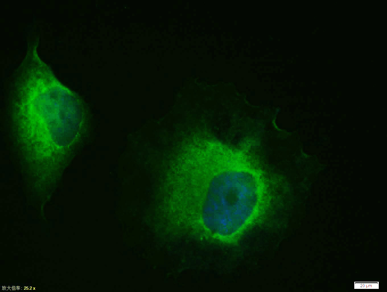 Hela cell; 4% Paraformaldehyde-fixed; Triton X-100 at room temperature for 20 min; Blocking buffer (normal goat serum, C-0005) at 37°C for 20 min; Antibody incubation with (HSP70) polyclonal Antibody, Unconjugated (bs-0126R) 1:100, 90 minutes at 37°C; followed by a conjugated Goat Anti-Rabbit IgG antibody at 37°C for 90 minutes, DAPI (blue, C02-04002) was used to stain the cell nuclei.