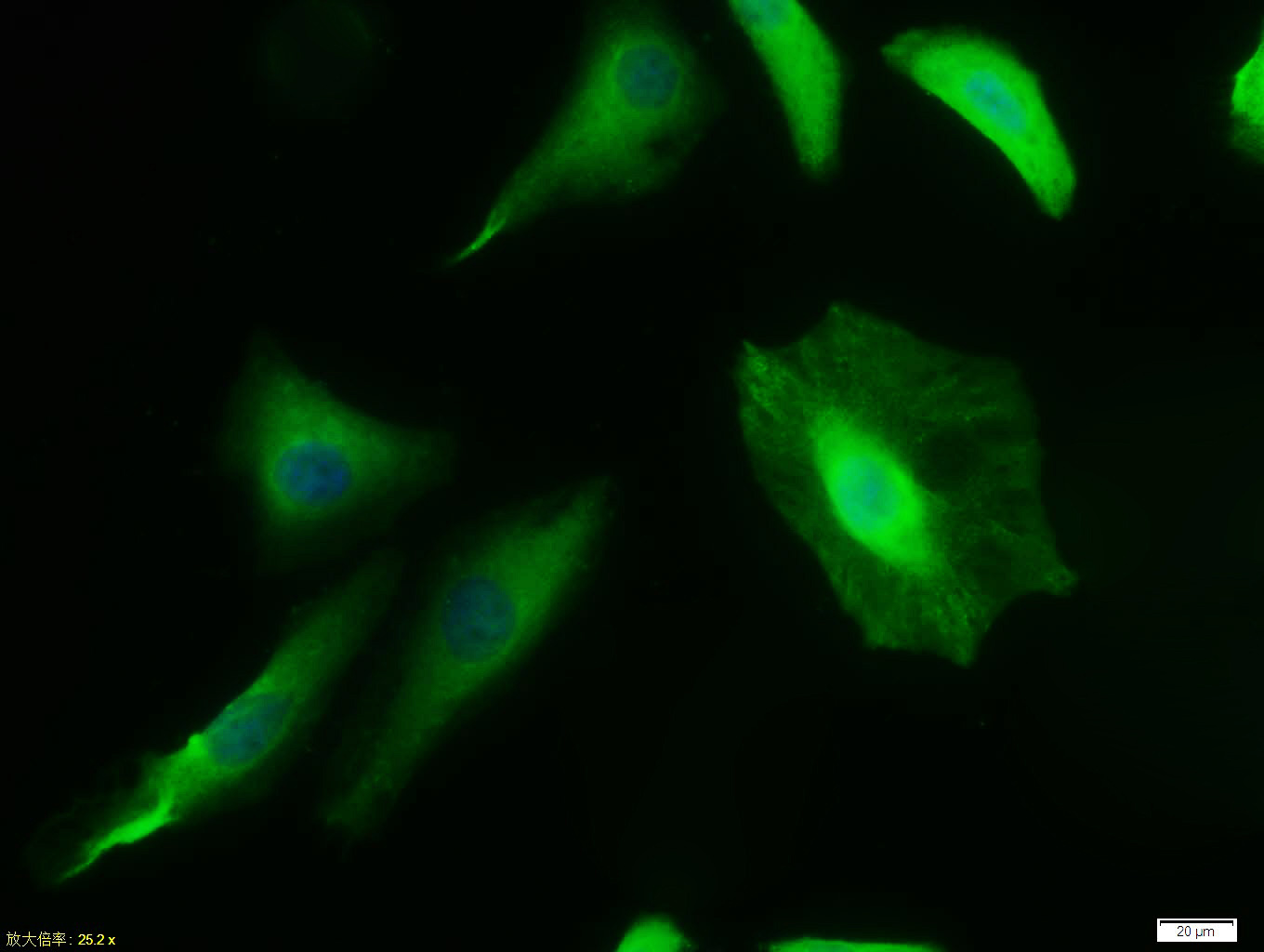 Hela cell; 4% Paraformaldehyde-fixed; Triton X-100 at room temperature for 20 min; Blocking buffer (normal goat serum, C-0005) at 37°C for 20 min; Antibody incubation with (DR5) polyclonal Antibody, Unconjugated (bs-1696R) 1:100, 90 minutes at 37°C; followed by a conjugated Goat Anti-Rabbit IgG antibody at 37°C for 90 minutes, DAPI (blue, C02-04002) was used to stain the cell nuclei.