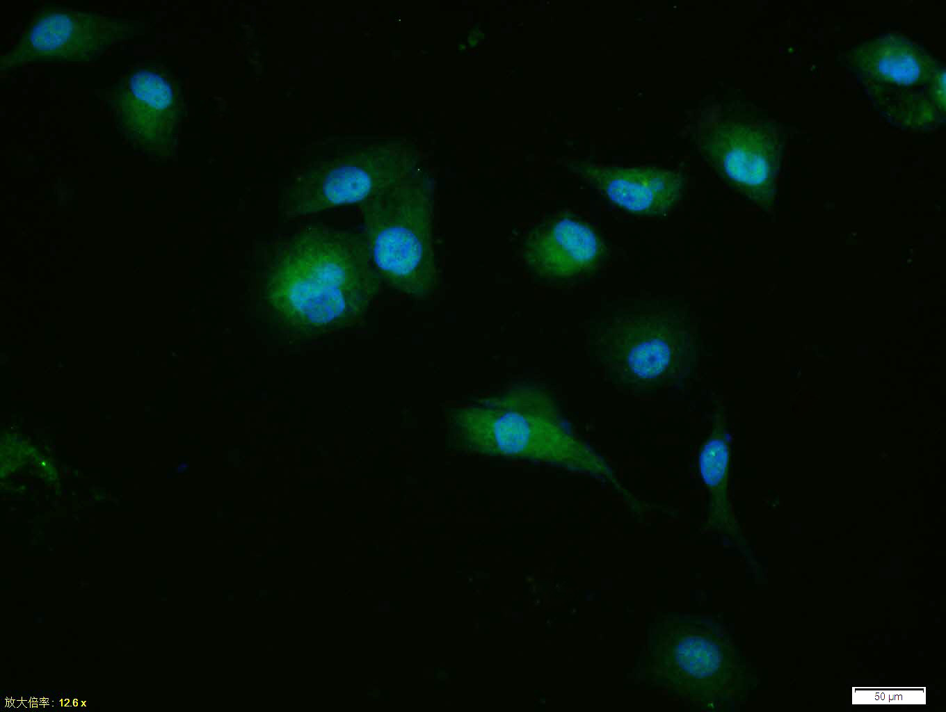 Tissue/cell: HUVEC cell; 4% Paraformaldehyde-fixed; Triton X-100 at room temperature for 20 min; Blocking buffer (normal goat serum, C-0005) at 37°C for 20 min; Antibody incubation with (CDKN1A/p21) Polyclonal Antibody, Unconjugated (bs-0741R) 1:100, 90 minutes at 37°C; followed by a conjugated Goat Anti-Rabbit IgG antibody (bs-0295G-FITC) at 37°C for 90 minutes, DAPI (blue, C02-04002) was used to stain the cell nuclei