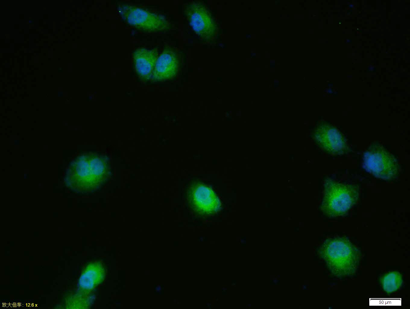 Tissue\/cell: HUVEC cell; 4% Paraformaldehyde-fixed; Triton X-100 at room temperature for 20 min; Blocking buffer (normal goat serum, C-0005) at 37\u00b0C for 20 min; Antibody incubation with (Estrogen Receptor alpha + beta ) Polyclonal Antibody, Unconjugated (bs-0174R) 1:100, 90 minutes at 37\u00b0C; followed by a conjugated Goat Anti-Rabbit IgG antibody (bs-0295G-FITC) at 37\u00b0C for 90 minutes, DAPI (blue, C02-04002) was used to stain the cell nuclei.