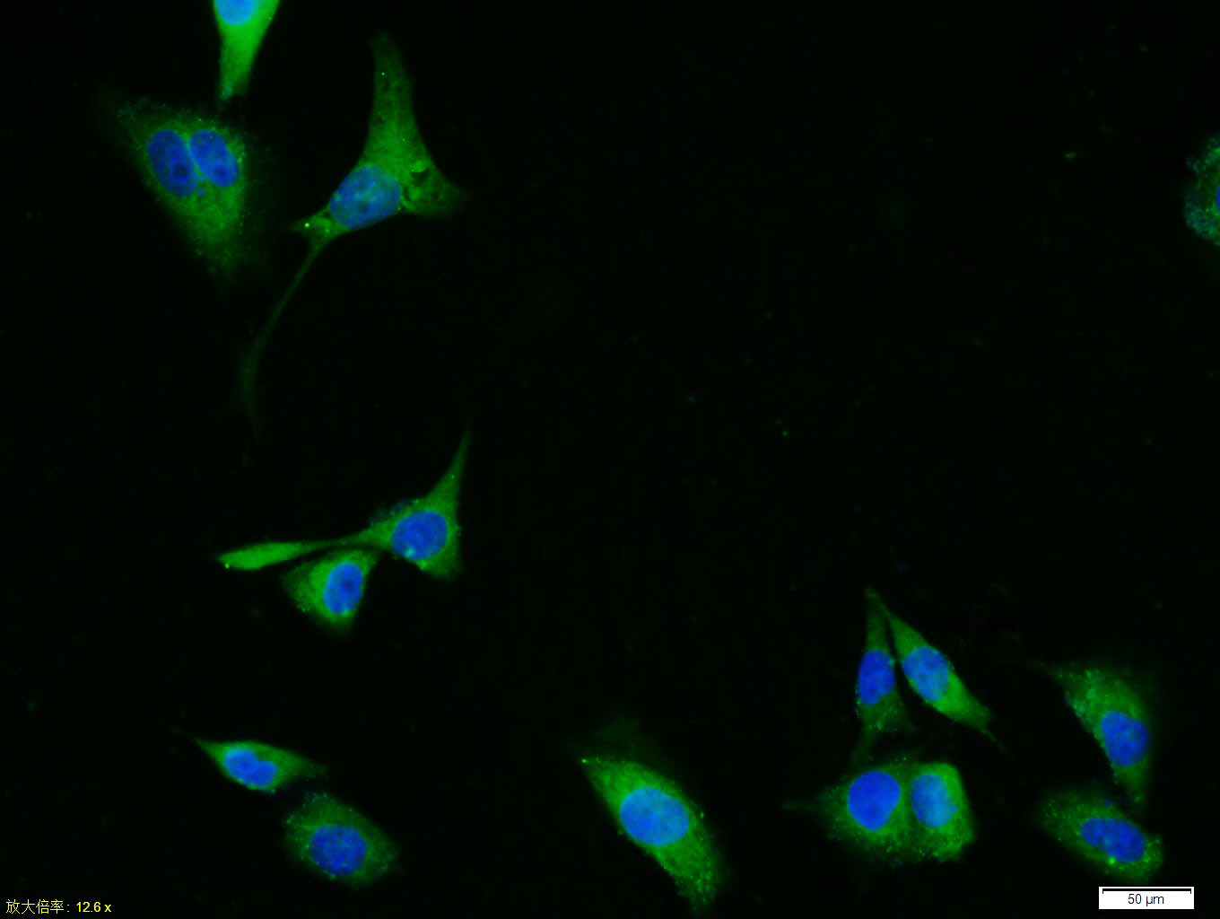 Tissue/cell: HUVEC cell; 4% Paraformaldehyde-fixed; Triton X-100 at room temperature for 20 min; Blocking buffer (normal goat serum, C-0005) at 37°C for 20 min; Antibody incubation with (phospho-ERK1 + 2 (Thr183/Tyr185)) Polyclonal Antibody, Unconjugated (bs-1522R) 1:100, 90 minutes at 37°C; followed by a conjugated Goat Anti-Rabbit IgG antibody (bs-0295G-FITC) at 37°C for 90 minutes, DAPI (blue, C02-04002) was used to stain the cell nuclei.