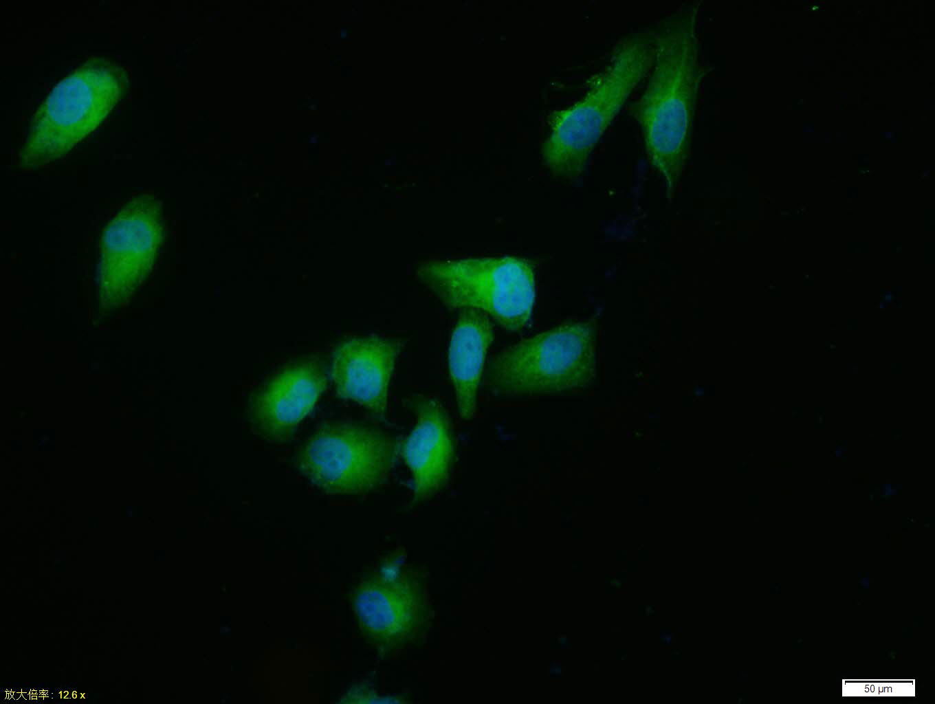 Tissue/cell: HUVEC cell; 4% Paraformaldehyde-fixed; Triton X-100 at room temperature for 20 min; Blocking buffer (normal goat serum, C-0005) at 37°C for 20 min; Antibody incubation with (ERK1) polyclonal Antibody, Unconjugated (bs-1020R) 1:100, 90 minutes at 37°C; followed by a FITC conjugated Goat Anti-Rabbit IgG antibody at 37°C for 90 minutes, DAPI (blue, C02-04002) was used to stain the cell nuclei.