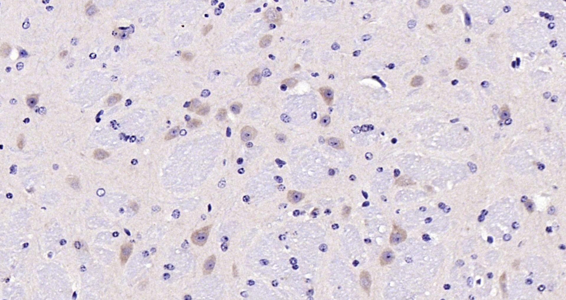 Paraformaldehyde-fixed, paraffin embedded Mouse brain; Antigen retrieval by boiling in sodium citrate buffer (pH6.0) for 15min; Block endogenous peroxidase by 3% hydrogen peroxide for 20 minutes; Blocking buffer (normal goat serum) at 37°C for 30min; Antibody incubation with Tyrosine Hydroxylase Polyclonal Antibody, Unconjugated (bs-0016R) at 1:200 overnight at 4°C, DAB staining.