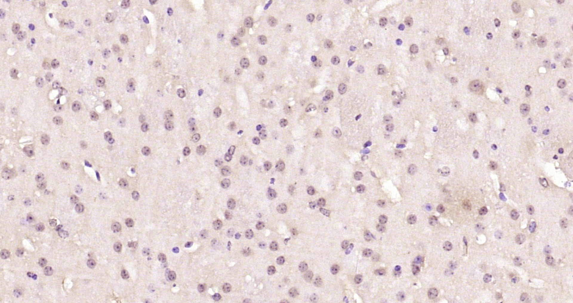 Paraformaldehyde-fixed, paraffin embedded Mouse brain; Antigen retrieval by boiling in sodium citrate buffer (pH6.0) for 15min; Block endogenous peroxidase by 3% hydrogen peroxide for 20 minutes; Blocking buffer (normal goat serum) at 37°C for 30min; Antibody incubation with CREB-1 Polyclonal Antibody, Unconjugated (bs-0035R) at 1:200 overnight at 4°C, DAB staining.