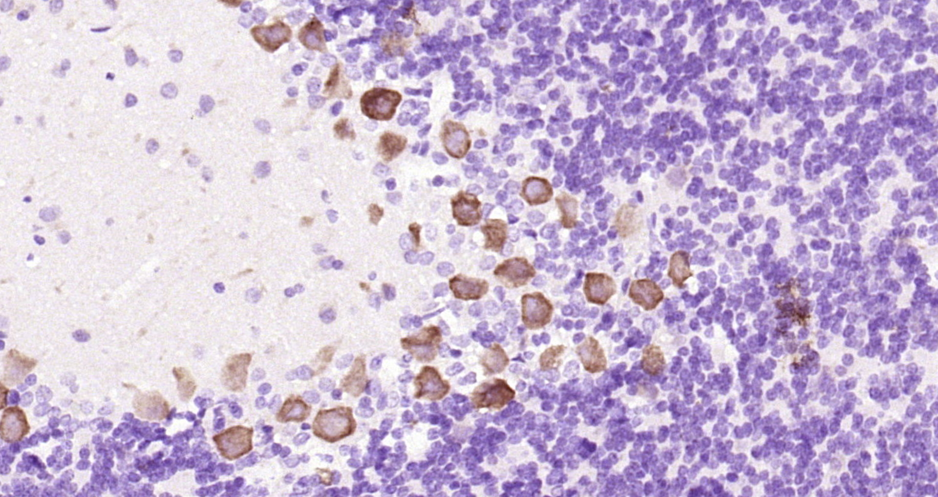 Paraformaldehyde-fixed, paraffin embedded Rat cerebellum; Antigen retrieval by boiling in sodium citrate buffer (pH6.0) for 15min; Block endogenous peroxidase by 3% hydrogen peroxide for 20 minutes; Blocking buffer (normal goat serum) at 37°C for 30min; Antibody incubation with GAP43 (Ser41) Polyclonal Antibody, Unconjugated (bs-1641R) at 1:200 overnight at 4°C, DAB staining.