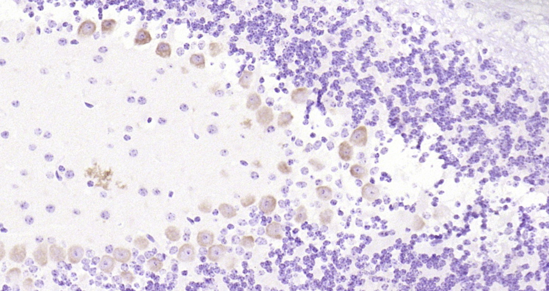 Paraformaldehyde-fixed, paraffin embedded Mouse cerebellum; Antigen retrieval by boiling in sodium citrate buffer (pH6.0) for 15min; Block endogenous peroxidase by 3% hydrogen peroxide for 20 minutes; Blocking buffer (normal goat serum) at 37°C for 30min; Antibody incubation with GAP43 (Ser41) Polyclonal Antibody, Unconjugated (bs-1641R) at 1:200 overnight at 4°C, DAB staining.
