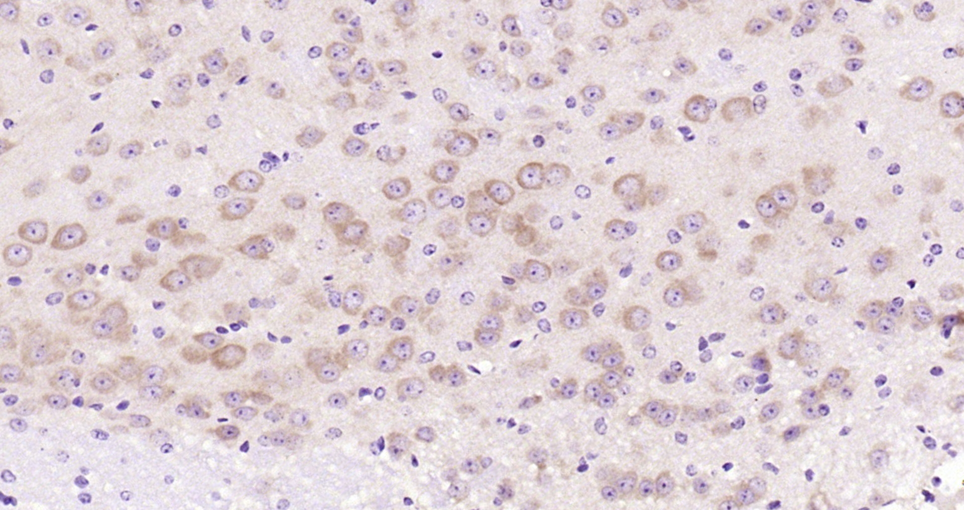 Paraformaldehyde-fixed, paraffin embedded Mouse brain; Antigen retrieval by boiling in sodium citrate buffer (pH6.0) for 15min; Block endogenous peroxidase by 3% hydrogen peroxide for 20 minutes; Blocking buffer (normal goat serum) at 37°C for 30min; Antibody incubation with GAP43 (Ser41) Polyclonal Antibody, Unconjugated (bs-1641R) at 1:200 overnight at 4°C, DAB staining.