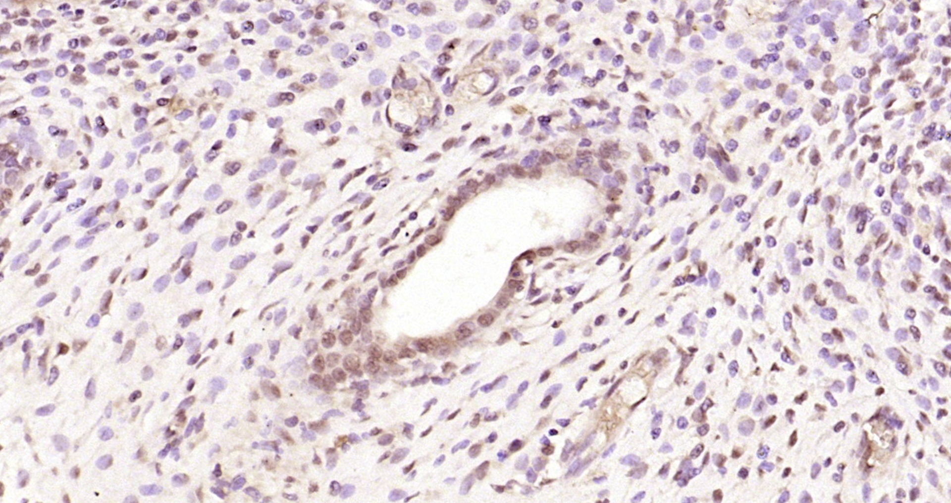 Paraformaldehyde-fixed, paraffin embedded Rat uterus; Antigen retrieval by boiling in sodium citrate buffer (pH6.0) for 15min; Block endogenous peroxidase by 3% hydrogen peroxide for 20 minutes; Blocking buffer (normal goat serum) at 37°C for 30min; Antibody incubation with Estrogen Receptor alpha Polyclonal Antibody, Unconjugated (bs-2098R) at 1:200 overnight at 4°C, DAB staining.