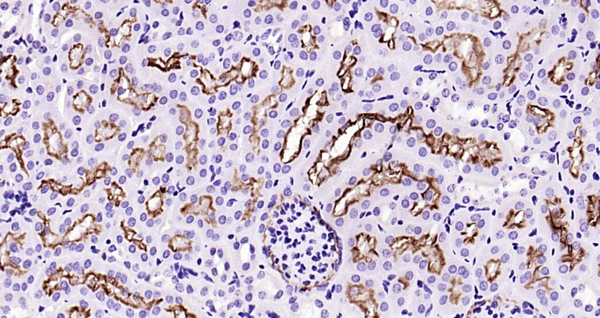 Paraformaldehyde-fixed, paraffin embedded Rat kidney; Antigen retrieval by boiling in sodium citrate buffer (pH6.0) for 15min; Block endogenous peroxidase by 3% hydrogen peroxide for 20 minutes; Blocking buffer (normal goat serum) at 37°C for 30min; Antibody incubation with Angiotensin Converting Enzyme 2 (3F1) Monoclonal Antibody, Unconjugated (bsm-52614R) at 1:200 overnight at 4°C, DAB staining.
