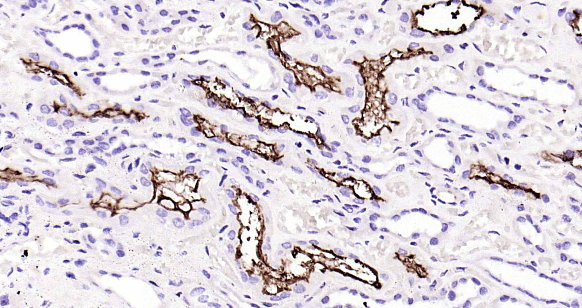 Paraformaldehyde-fixed, paraffin embedded Human kidney; Antigen retrieval by boiling in sodium citrate buffer (pH6.0) for 15min; Block endogenous peroxidase by 3% hydrogen peroxide for 20 minutes; Blocking buffer (normal goat serum) at 37°C for 30min; Antibody incubation with Angiotensin Converting Enzyme 2 (3F1) Monoclonal Antibody, Unconjugated (bsm-52614R) at 1:200 overnight at 4°C, DAB staining.