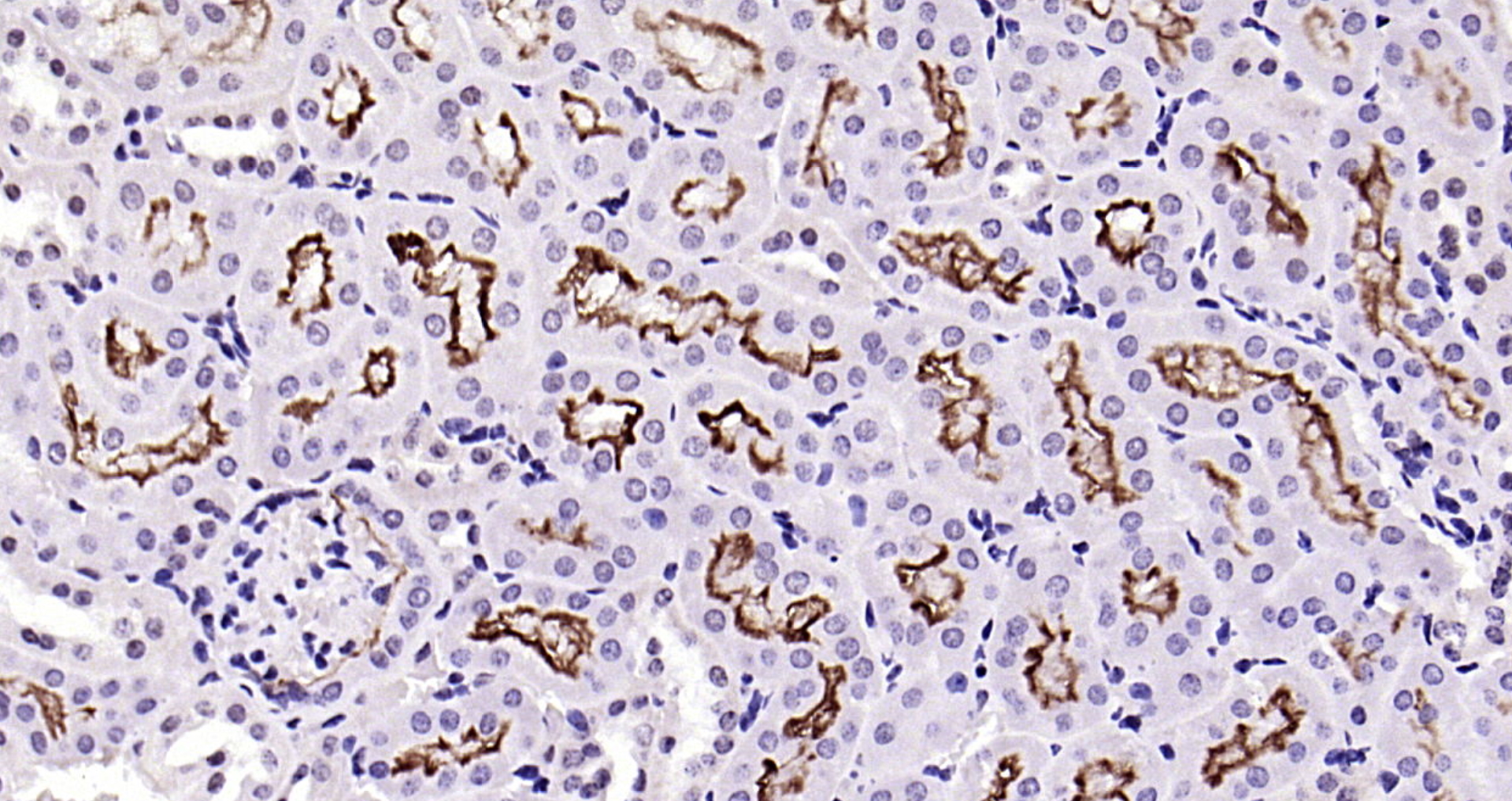 Paraformaldehyde-fixed, paraffin embedded Mouse kidney; Antigen retrieval by boiling in sodium citrate buffer (pH6.0) for 15min; Block endogenous peroxidase by 3% hydrogen peroxide for 20 minutes; Blocking buffer (normal goat serum) at 37°C for 30min; Antibody incubation with Angiotensin Converting Enzyme 2 (3F1) Monoclonal Antibody, Unconjugated (bsm-52614R) at 1:200 overnight at 4°C, DAB staining.
