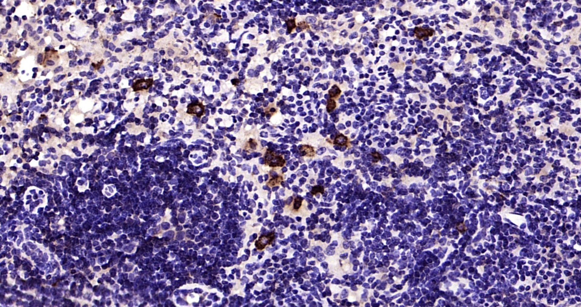 Paraformaldehyde-fixed, paraffin embedded Mouse lymph node; Antigen retrieval by boiling in sodium citrate buffer (pH6.0) for 15min; Block endogenous peroxidase by 3% hydrogen peroxide for 20 minutes; Blocking buffer (normal goat serum) at 37°C for 30min; Antibody incubation with CD27 (3C3) Monoclonal Antibody, Unconjugated (bsm-54318R) at 1:200 overnight at 4°C, DAB staining.