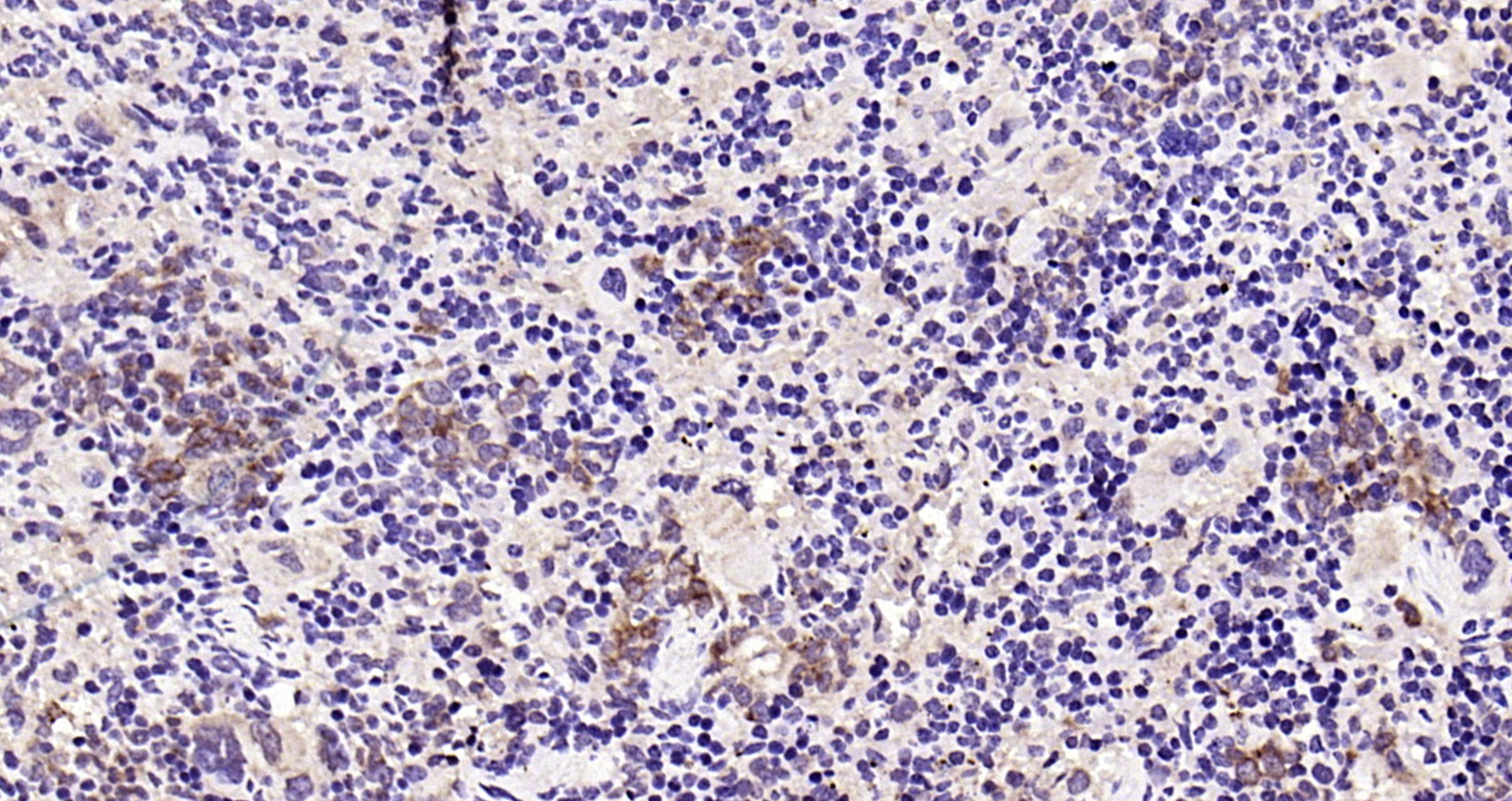 Paraformaldehyde-fixed, paraffin embedded Mouse spleen; Antigen retrieval by boiling in sodium citrate buffer (pH6.0) for 15min; Block endogenous peroxidase by 3% hydrogen peroxide for 20 minutes; Blocking buffer (normal goat serum) at 37°C for 30min; Antibody incubation with CD27 (3C3) Monoclonal Antibody, Unconjugated (bsm-54318R) at 1:200 overnight at 4°C, DAB staining.