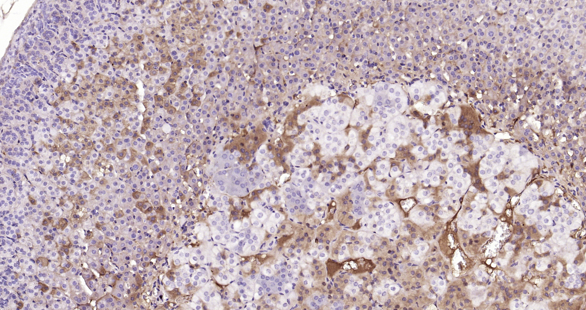 Paraformaldehyde-fixed, paraffin embedded Mouse adrenal gland; Antigen retrieval by boiling in sodium citrate buffer (pH6.0) for 15min; Block endogenous peroxidase by 3% hydrogen peroxide for 20 minutes; Blocking buffer (normal goat serum) at 37°C for 30min; Antibody incubation with SEC14L1 Polyclonal Antibody, Unconjugated (bs-4447R) at 1:200 overnight at 4°C, DAB staining.