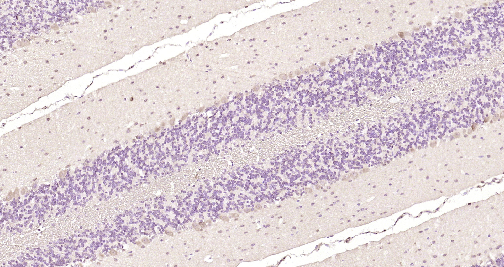 Paraformaldehyde-fixed, paraffin embedded Mouse cerebellum; Antigen retrieval by boiling in sodium citrate buffer (pH6.0) for 15min; Block endogenous peroxidase by 3% hydrogen peroxide for 20 minutes; Blocking buffer (normal goat serum) at 37°C for 30min; Antibody incubation with PIK3R5 Polyclonal Antibody, Unconjugated (bs-7467R) at 1:200 overnight at 4°C, DAB staining. Paraformaldehyde-fixed, paraffin embedded Mouse cerebellum; Antigen retrieval by boiling in sodium citrate buffer (pH6.0) for 15min; Block endogenous peroxidase by 3% hydrogen peroxide for 20 minutes; Blocking buffer (normal goat serum) at 37°C for 30min; Antibody incubation with PIK3R5 Polyclonal Antibody, Unconjugated (bs-7467R) at 1:200 overnight at 4°C, DAB staining.