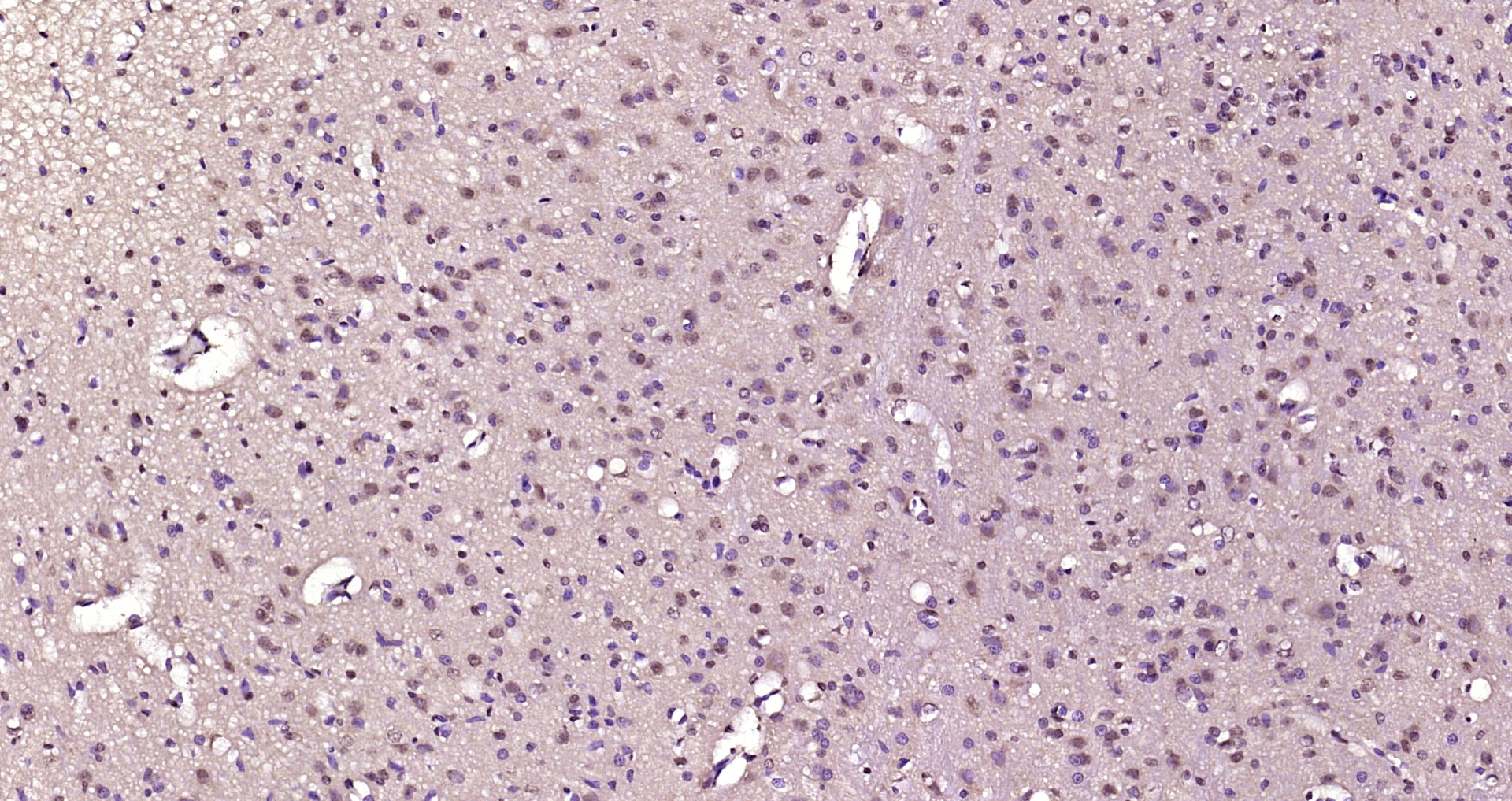 Paraformaldehyde-fixed, paraffin embedded Rat brain; Antigen retrieval by boiling in sodium citrate buffer (pH6.0) for 15min; Block endogenous peroxidase by 3% hydrogen peroxide for 20 minutes; Blocking buffer (normal goat serum) at 37°C for 30min; Antibody incubation with SEH1L Polyclonal Antibody, Unconjugated (bs-8721R) at 1:200 overnight at 4°C, DAB staining.