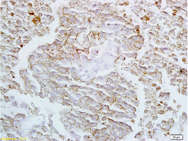 Formalin-fixed and paraffin embedded rat lung labeled with Anti-Claudin-4 Polyclonal Antibody, Unconjugated (bs-2790R) at 1:200 followed by conjugation to the secondary antibody and DAB staining
