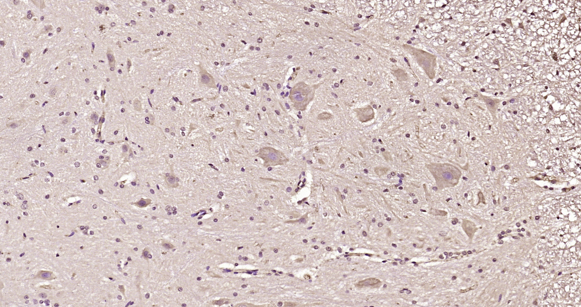 Paraformaldehyde-fixed, paraffin embedded Mouse brain; Antigen retrieval by boiling in sodium citrate buffer (pH6.0) for 15min; Block endogenous peroxidase by 3% hydrogen peroxide for 20 minutes; Blocking buffer (normal goat serum) at 37°C for 30min; Antibody incubation with GGCX Polyclonal Antibody, Unconjugated (bs-10530R) at 1:200 overnight at 4°C, DAB staining.