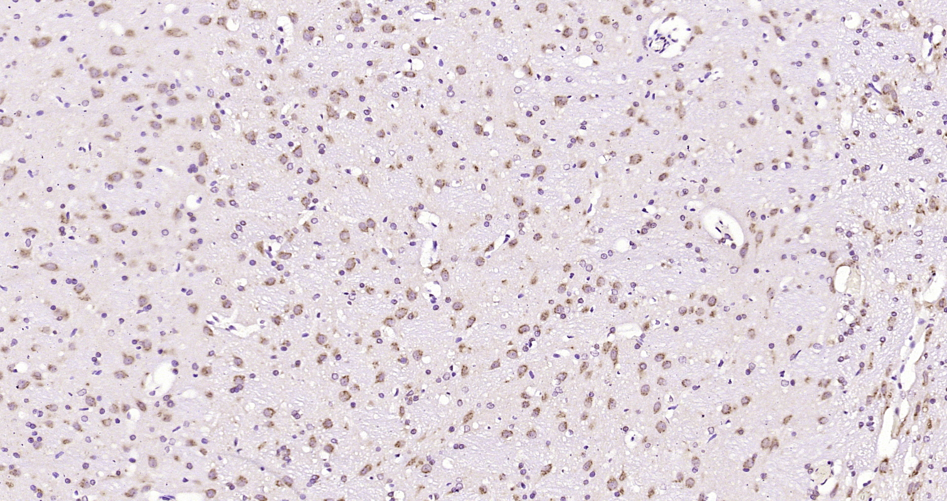 Paraformaldehyde-fixed, paraffin embedded Rat brain; Antigen retrieval by boiling in sodium citrate buffer (pH6.0) for 15min; Block endogenous peroxidase by 3% hydrogen peroxide for 20 minutes; Blocking buffer (normal goat serum) at 37°C for 30min; Antibody incubation with phospho-MST3 (Thr178) Polyclonal Antibody, Unconjugated (bs-10684R) at 1:200 overnight at 4°C, DAB staining.