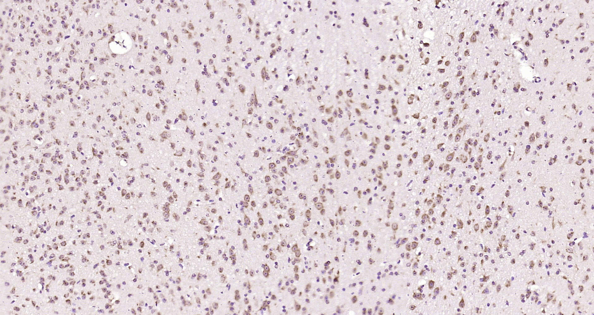 Paraformaldehyde-fixed, paraffin embedded Mouse brain; Antigen retrieval by boiling in sodium citrate buffer (pH6.0) for 15min; Block endogenous peroxidase by 3% hydrogen peroxide for 20 minutes; Blocking buffer (normal goat serum) at 37°C for 30min; Antibody incubation with phospho-MST3 (Thr178) Polyclonal Antibody, Unconjugated (bs-10684R) at 1:200 overnight at 4°C, DAB staining.