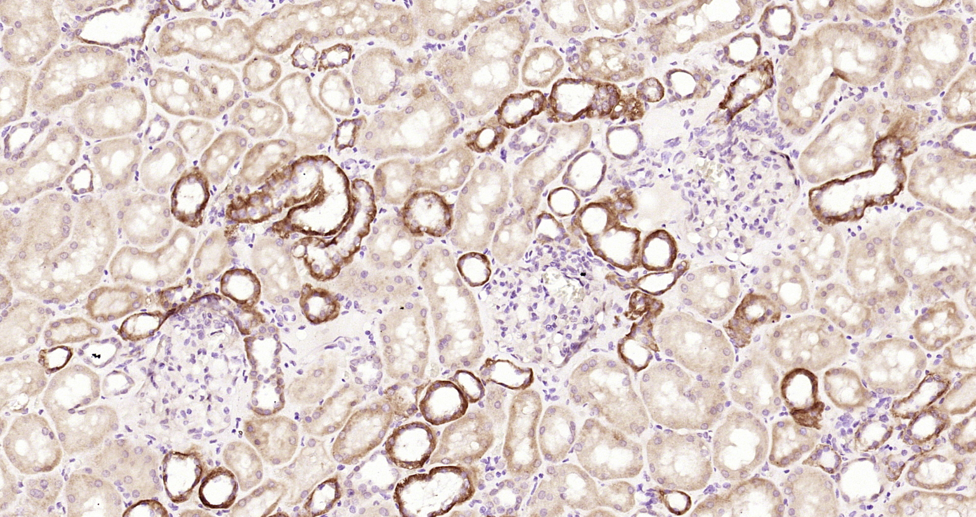 Paraformaldehyde-fixed, paraffin embedded Human kidney; Antigen retrieval by boiling in sodium citrate buffer (pH6.0) for 15min; Block endogenous peroxidase by 3% hydrogen peroxide for 20 minutes; Blocking buffer (normal goat serum) at 37°C for 30min; Antibody incubation with CCBL1 Polyclonal Antibody, Unconjugated (bs-10939R) at 1:200 overnight at 4°C, DAB staining.