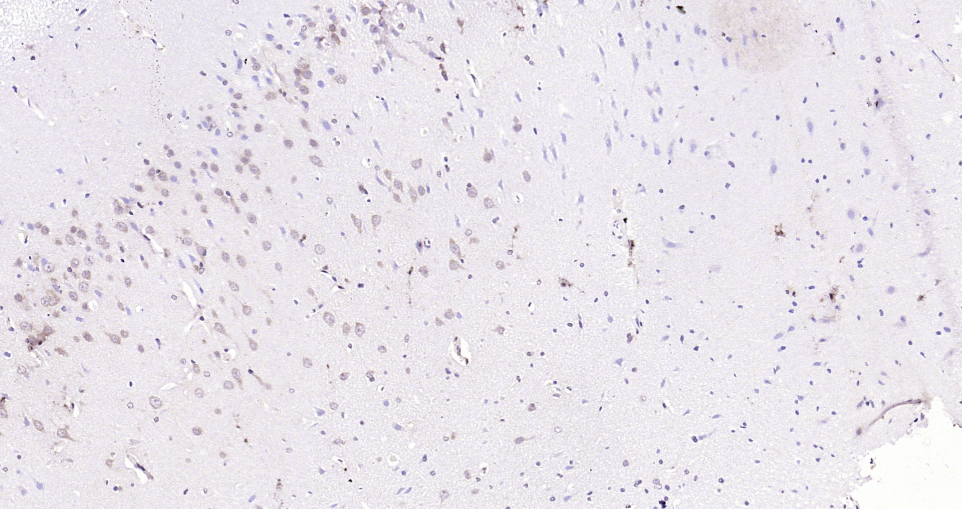 Paraformaldehyde-fixed, paraffin embedded Rat brain; Antigen retrieval by boiling in sodium citrate buffer (pH6.0) for 15min; Block endogenous peroxidase by 3% hydrogen peroxide for 20 minutes; Blocking buffer (normal goat serum) at 37°C for 30min; Antibody incubation with PEX13 Polyclonal Antibody, Unconjugated (bs-12620R) at 1:200 overnight at 4°C, DAB staining.