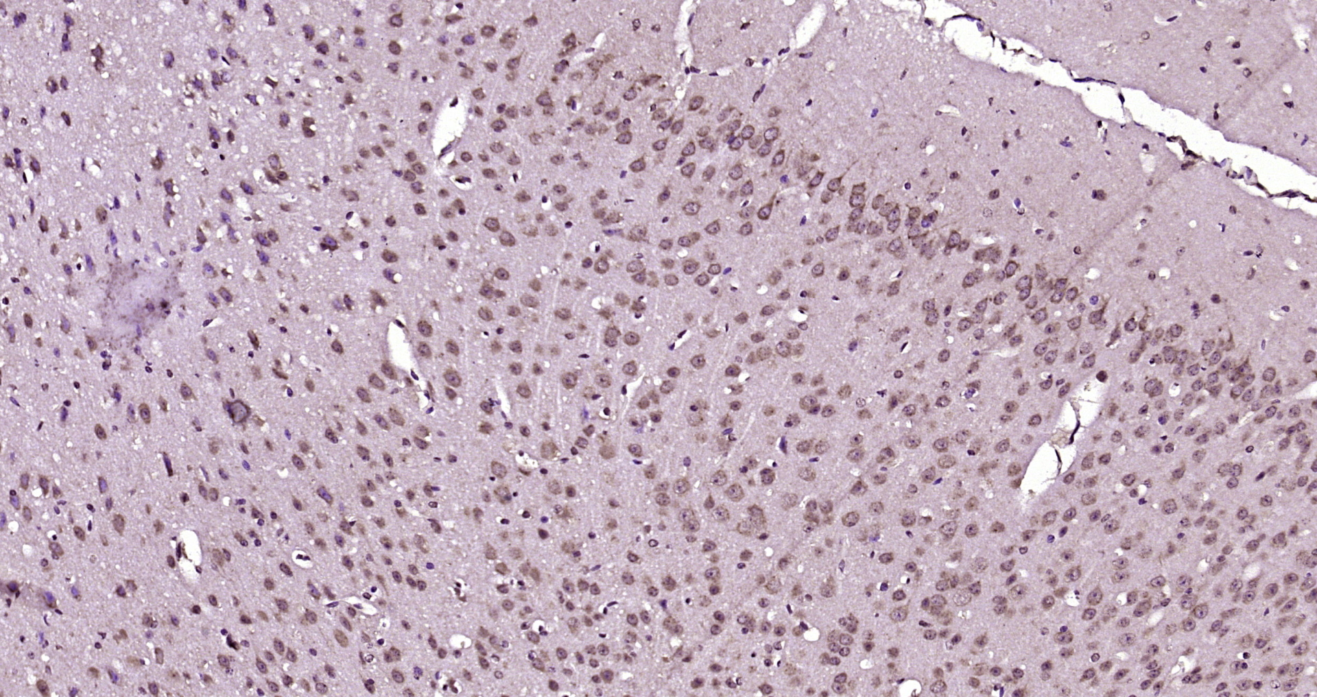 Paraformaldehyde-fixed, paraffin embedded Mouse cerebellum; Antigen retrieval by boiling in sodium citrate buffer (pH6.0) for 15min; Block endogenous peroxidase by 3% hydrogen peroxide for 20 minutes; Blocking buffer (normal goat serum) at 37°C for 30min; Antibody incubation with SMPD4 Polyclonal Antibody, Unconjugated (bs-12641R) at 1:200 overnight at 4°C, DAB staining.