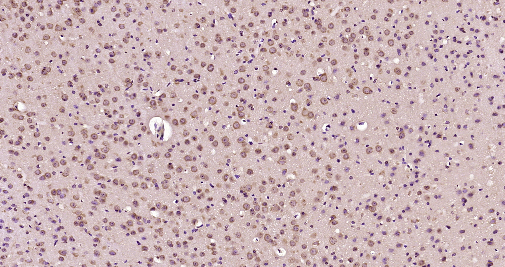 Paraformaldehyde-fixed, paraffin embedded Mouse brain; Antigen retrieval by boiling in sodium citrate buffer (pH6.0) for 15min; Block endogenous peroxidase by 3% hydrogen peroxide for 20 minutes; Blocking buffer (normal goat serum) at 37°C for 30min; Antibody incubation with MRP63 Polyclonal Antibody, Unconjugated (bs-13764R) at 1:200 overnight at 4°C, DAB staining.