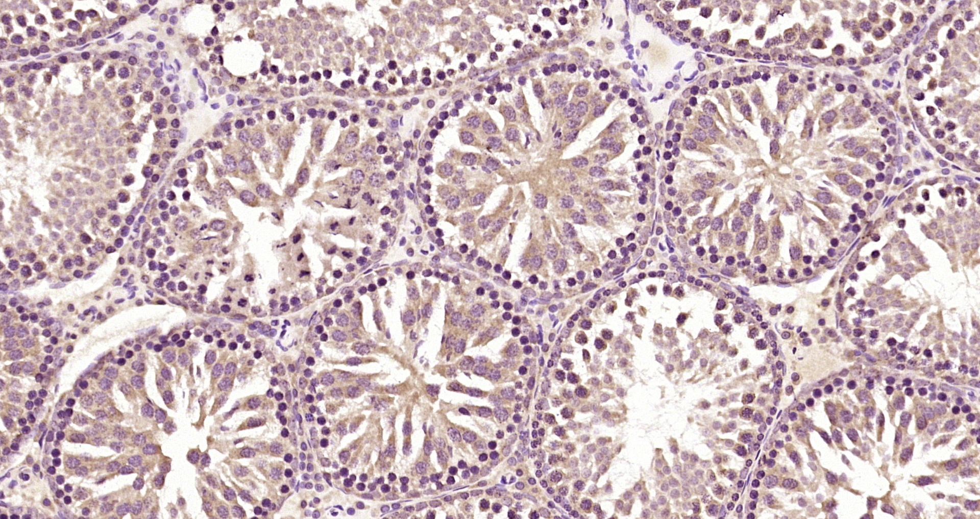 Paraformaldehyde-fixed, paraffin embedded Rat testis; Antigen retrieval by boiling in sodium citrate buffer (pH6.0) for 15min; Block endogenous peroxidase by 3% hydrogen peroxide for 20 minutes; Blocking buffer (normal goat serum) at 37°C for 30min; Antibody incubation with FAM172A Polyclonal Antibody, Unconjugated (bs-13772R) at 1:200 overnight at 4°C, DAB staining.
