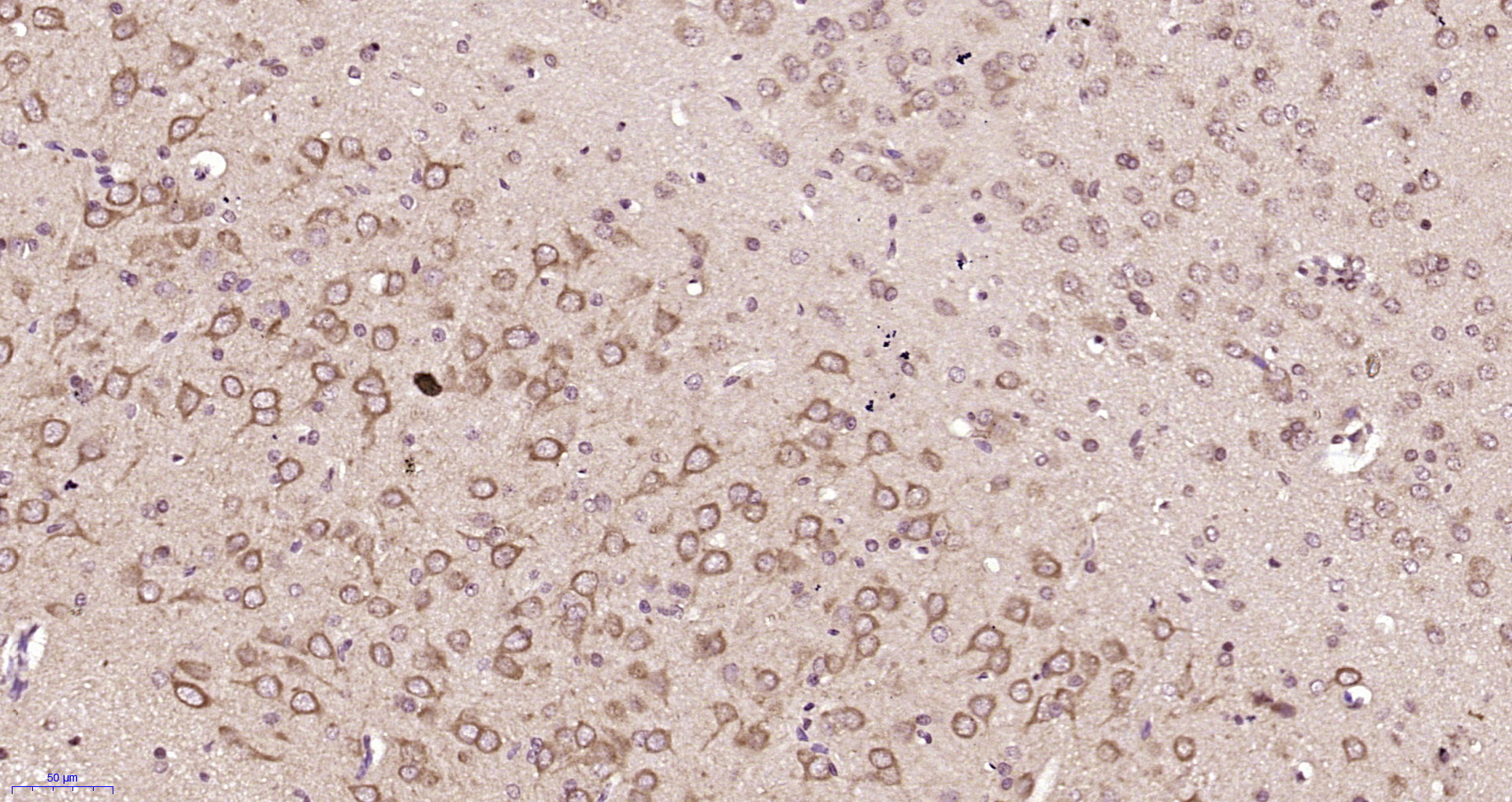 Paraformaldehyde-fixed, paraffin embedded Rat brain; Antigen retrieval by boiling in sodium citrate buffer (pH6.0) for 15min; Block endogenous peroxidase by 3% hydrogen peroxide for 20 minutes; Blocking buffer (normal goat serum) at 37°C for 30min; Antibody incubation with LC3A/B + LC3B + LC3C Polyclonal Antibody, Unconjugated (bs-13891R) at 1:200 overnight at 4°C, DAB staining.