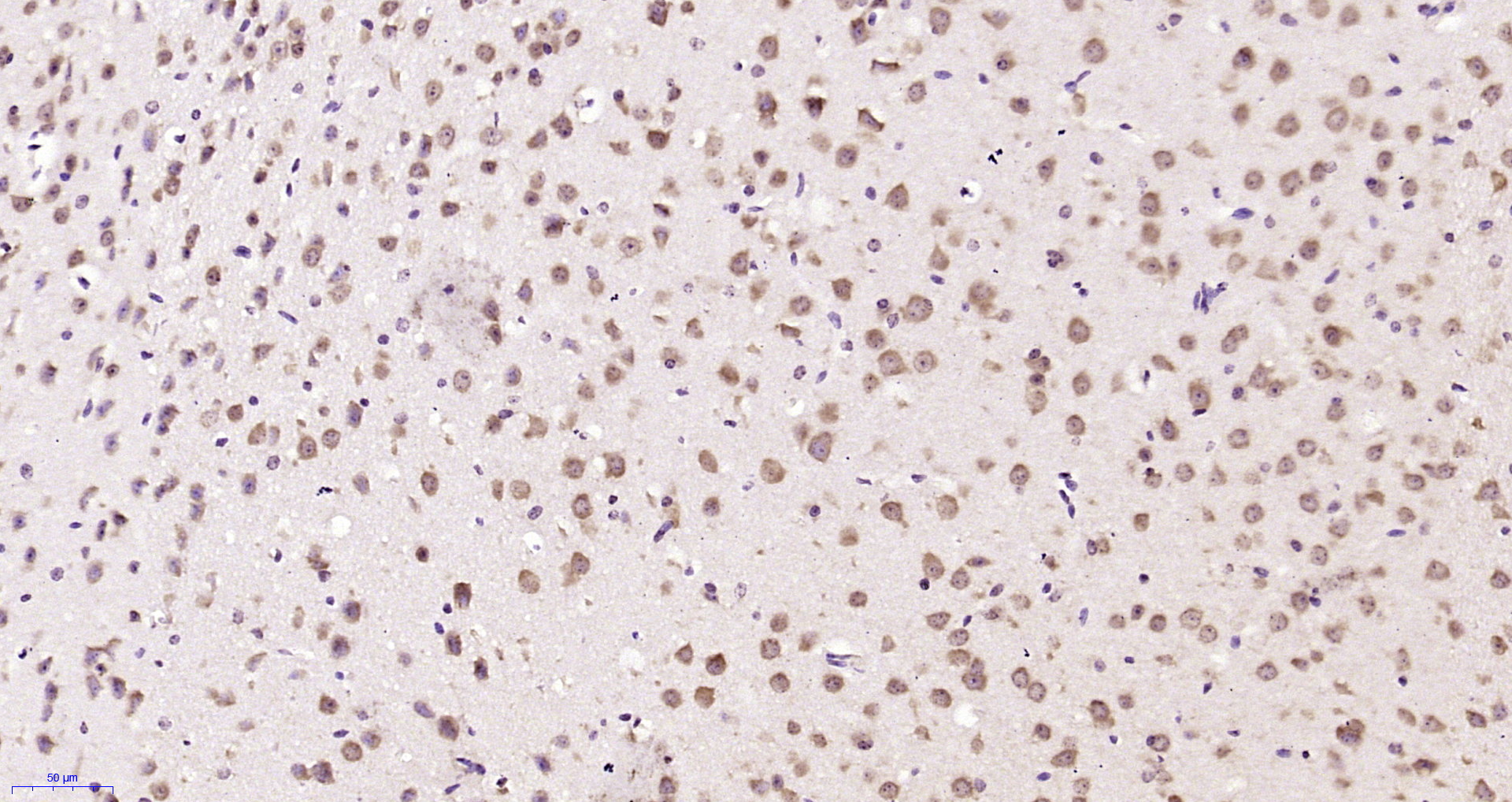 Paraformaldehyde-fixed, paraffin embedded Mouse brain; Antigen retrieval by boiling in sodium citrate buffer (pH6.0) for 15min; Block endogenous peroxidase by 3% hydrogen peroxide for 20 minutes; Blocking buffer (normal goat serum) at 37°C for 30min; Antibody incubation with CHST11 Polyclonal Antibody, Unconjugated (bs-13930R) at 1:200 overnight at 4°C, DAB staining.