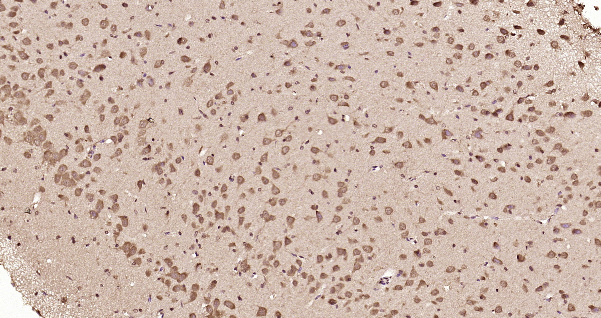 Paraformaldehyde-fixed, paraffin embedded Rat brain; Antigen retrieval by boiling in sodium citrate buffer (pH6.0) for 15min; Block endogenous peroxidase by 3% hydrogen peroxide for 20 minutes; Blocking buffer (normal goat serum) at 37°C for 30min; Antibody incubation with DENND5A Polyclonal Antibody, Unconjugated (bs-14274R) at 1:200 overnight at 4°C, DAB staining.