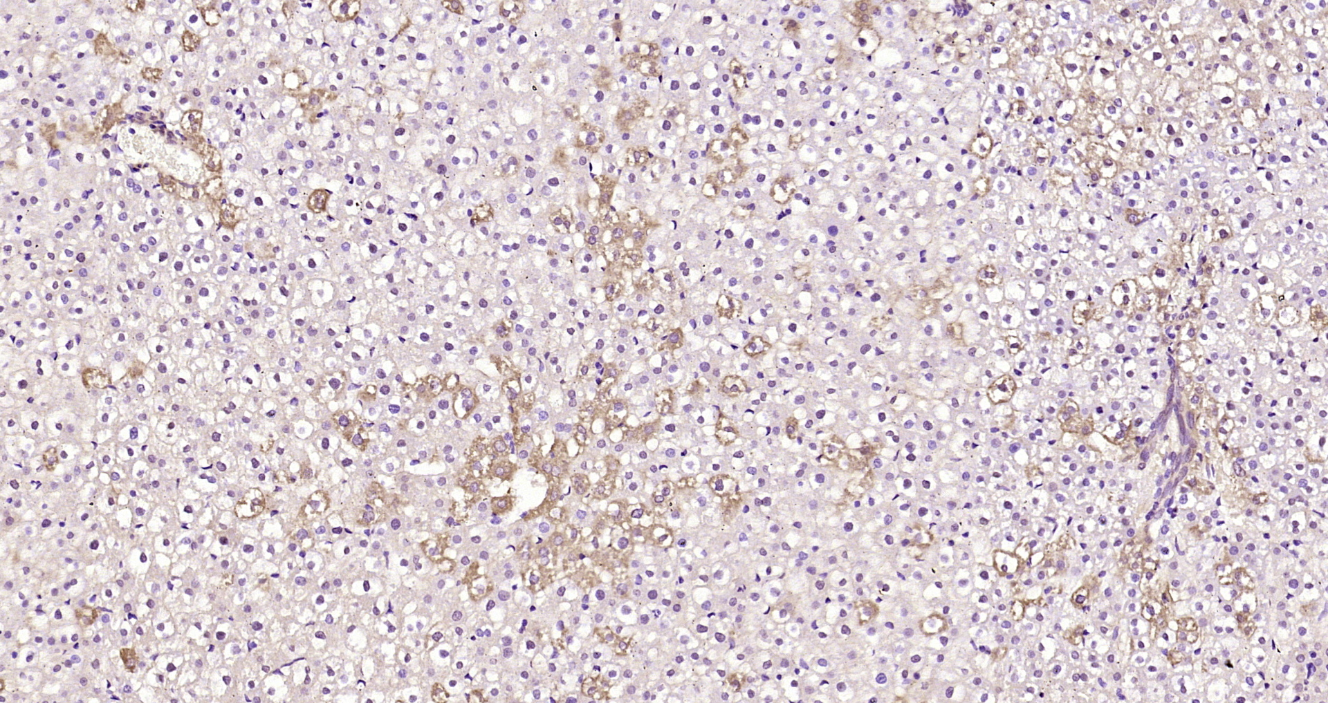 Paraformaldehyde-fixed, paraffin embedded Rat liver; Antigen retrieval by boiling in sodium citrate buffer (pH6.0) for 15min; Block endogenous peroxidase by 3% hydrogen peroxide for 20 minutes; Blocking buffer (normal goat serum) at 37°C for 30min; Antibody incubation with DIAPH3 Polyclonal Antibody, Unconjugated (bs-14325R) at 1:200 overnight at 4°C, DAB staining.