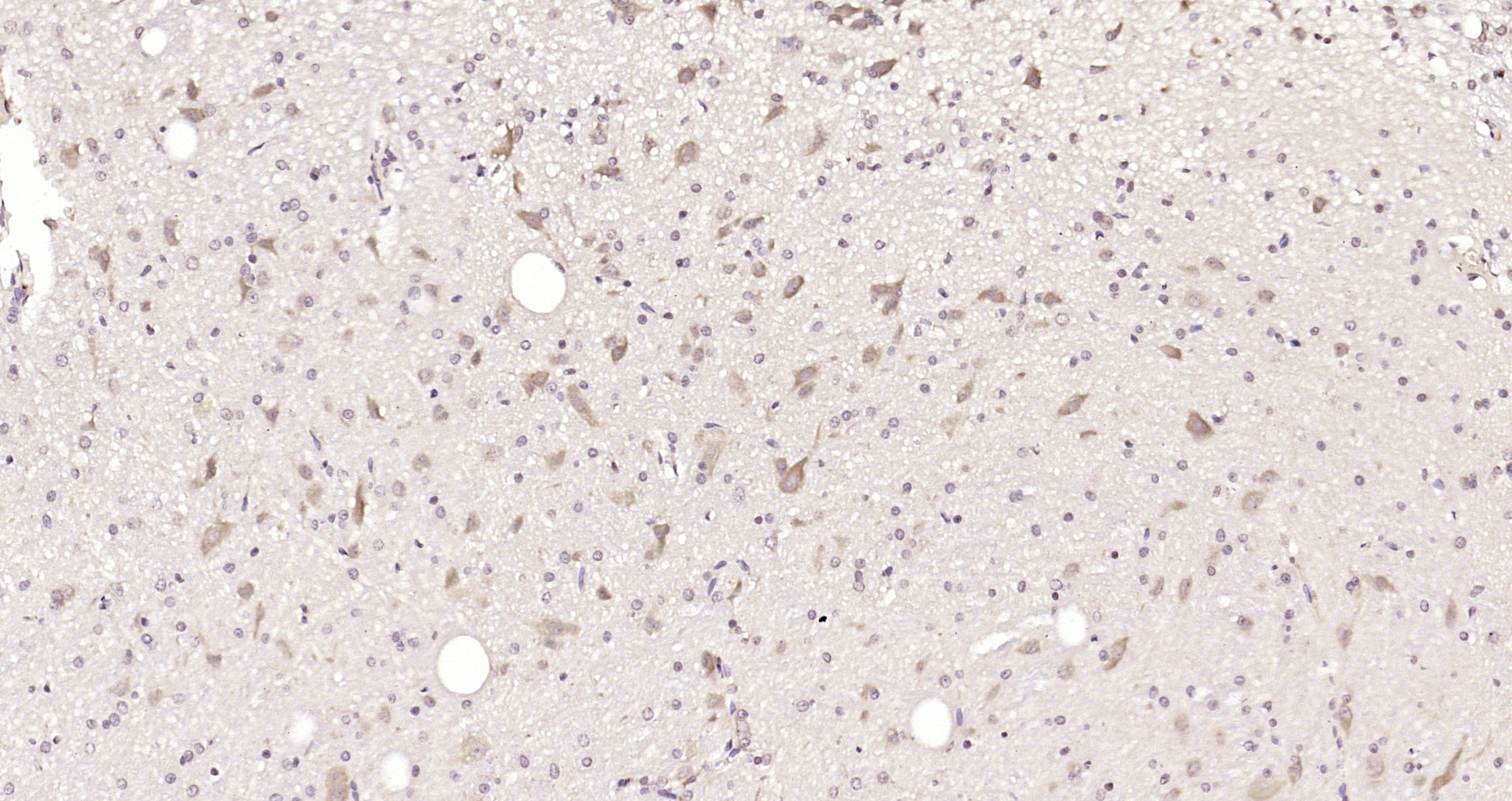 Paraformaldehyde-fixed, paraffin embedded Rat brain; Antigen retrieval by boiling in sodium citrate buffer (pH6.0) for 15min; Block endogenous peroxidase by 3% hydrogen peroxide for 20 minutes; Blocking buffer (normal goat serum) at 37°C for 30min; Antibody incubation with DIAPH3 Polyclonal Antibody, Unconjugated (bs-14325R) at 1:200 overnight at 4°C, DAB staining.