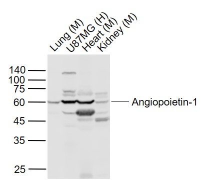 Lane 1: Mouse Lung lysates; Lane 2: U87MG cell lysates; Lane 3: Mouse Heart lysates; Lane 4: Mouse Kidney lysates probed with Angiopoietin 1 Polyclonal Antibody, Unconjugated (bs-0800R) at 1:1000 dilution and 4˚C overnight incubation. Followed by conjugated secondary antibody incubation at 1:20000 for 60 min at 37˚C.